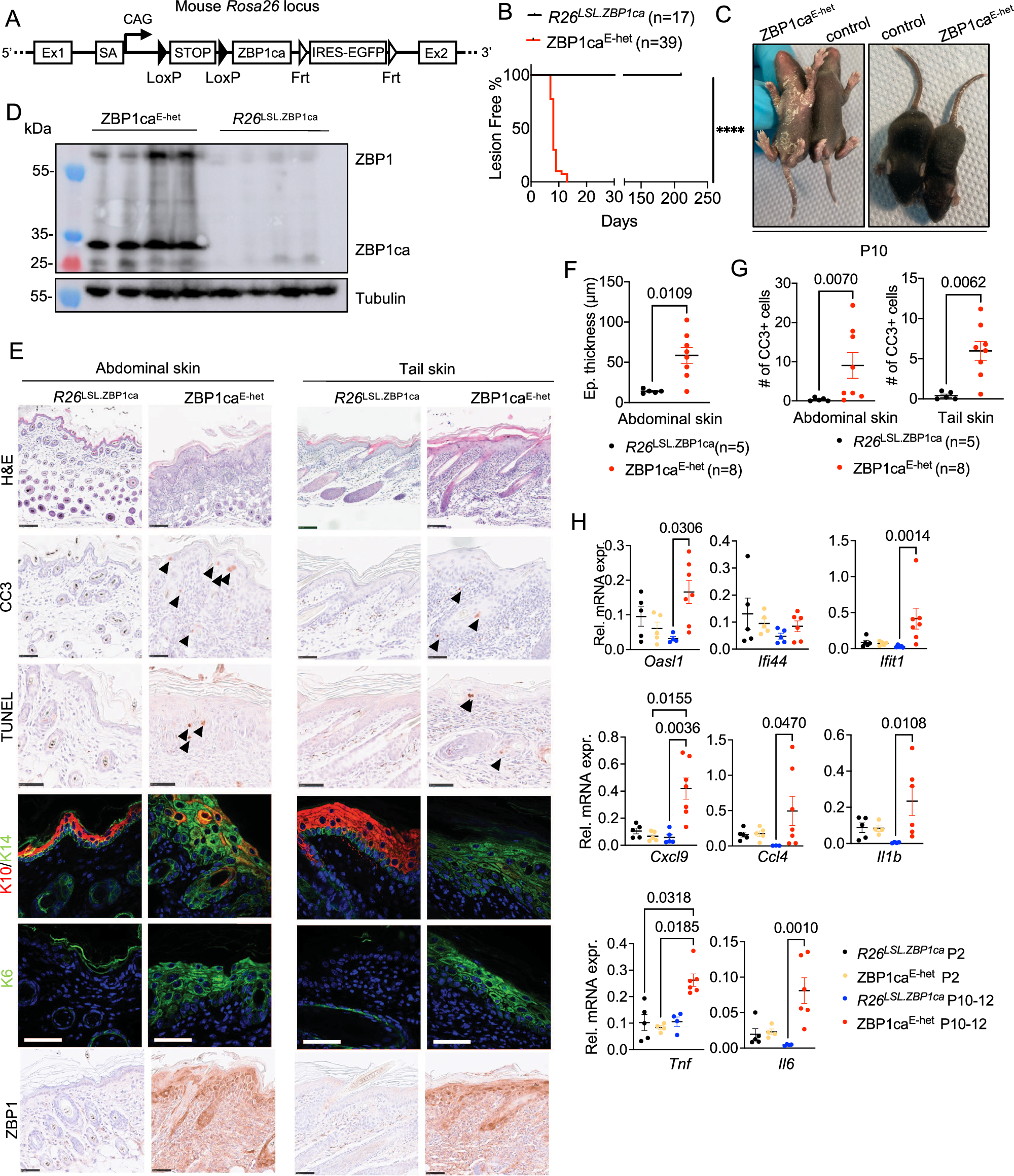 Fig. 4: ZBP1ca expression in keratinocytes causes skin inflammation.