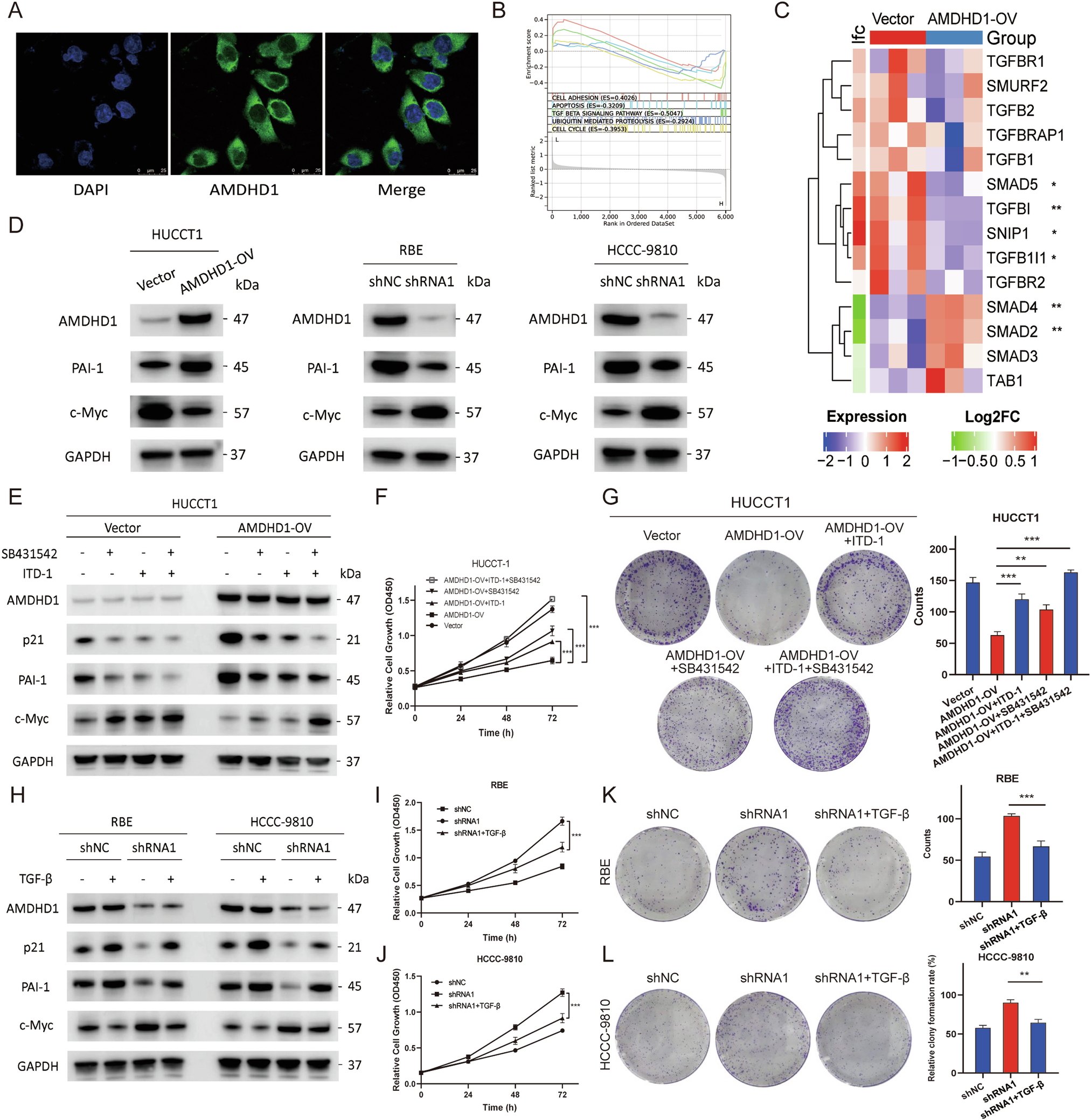 Fig. 4: AMDHD1 functions in a TGF-β dependent manner.