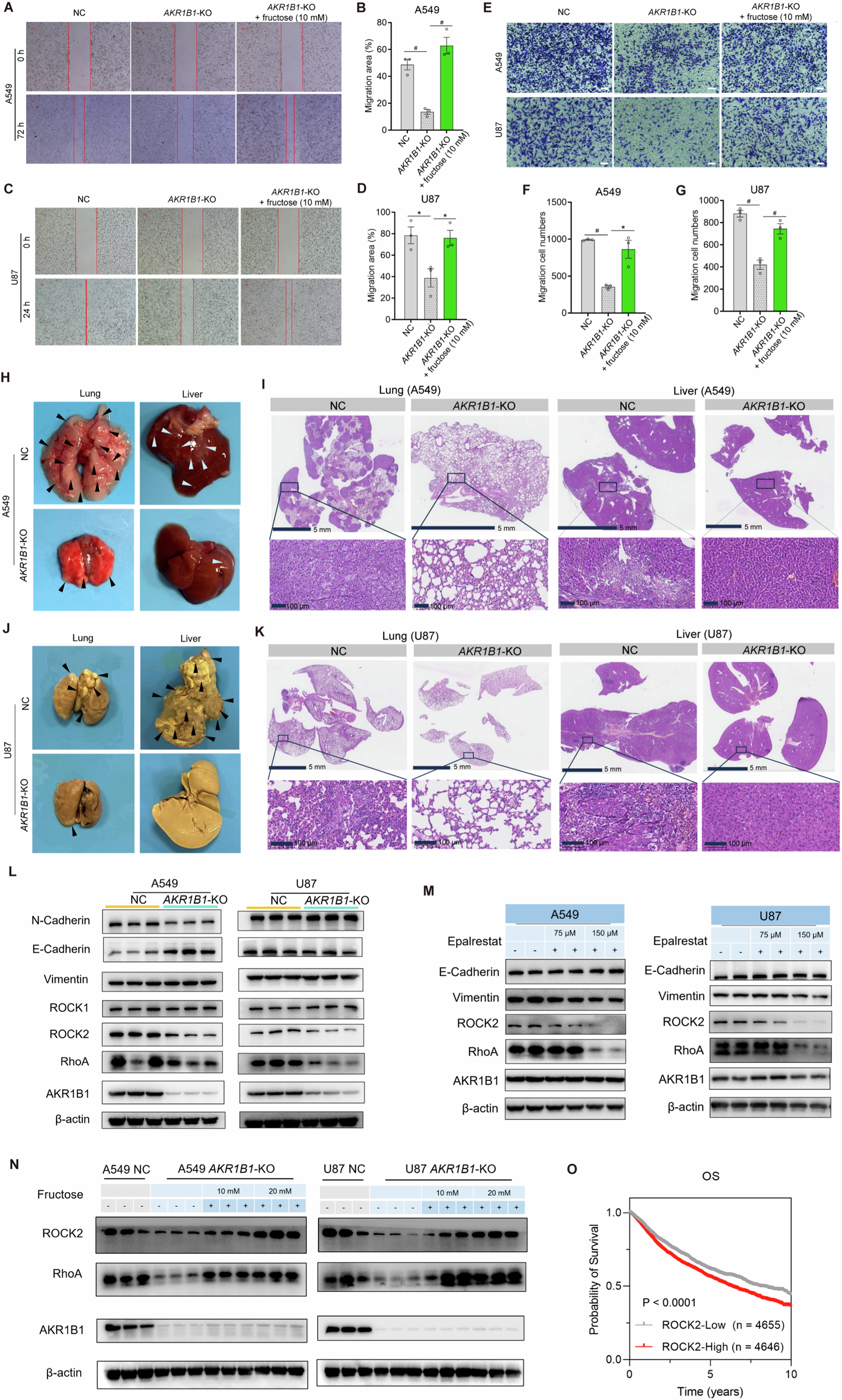 Fig. 7: AKR1B1-mediated fructose production from glucose enhanced cancer cell migration via RhoA-ROCK2 pathway.