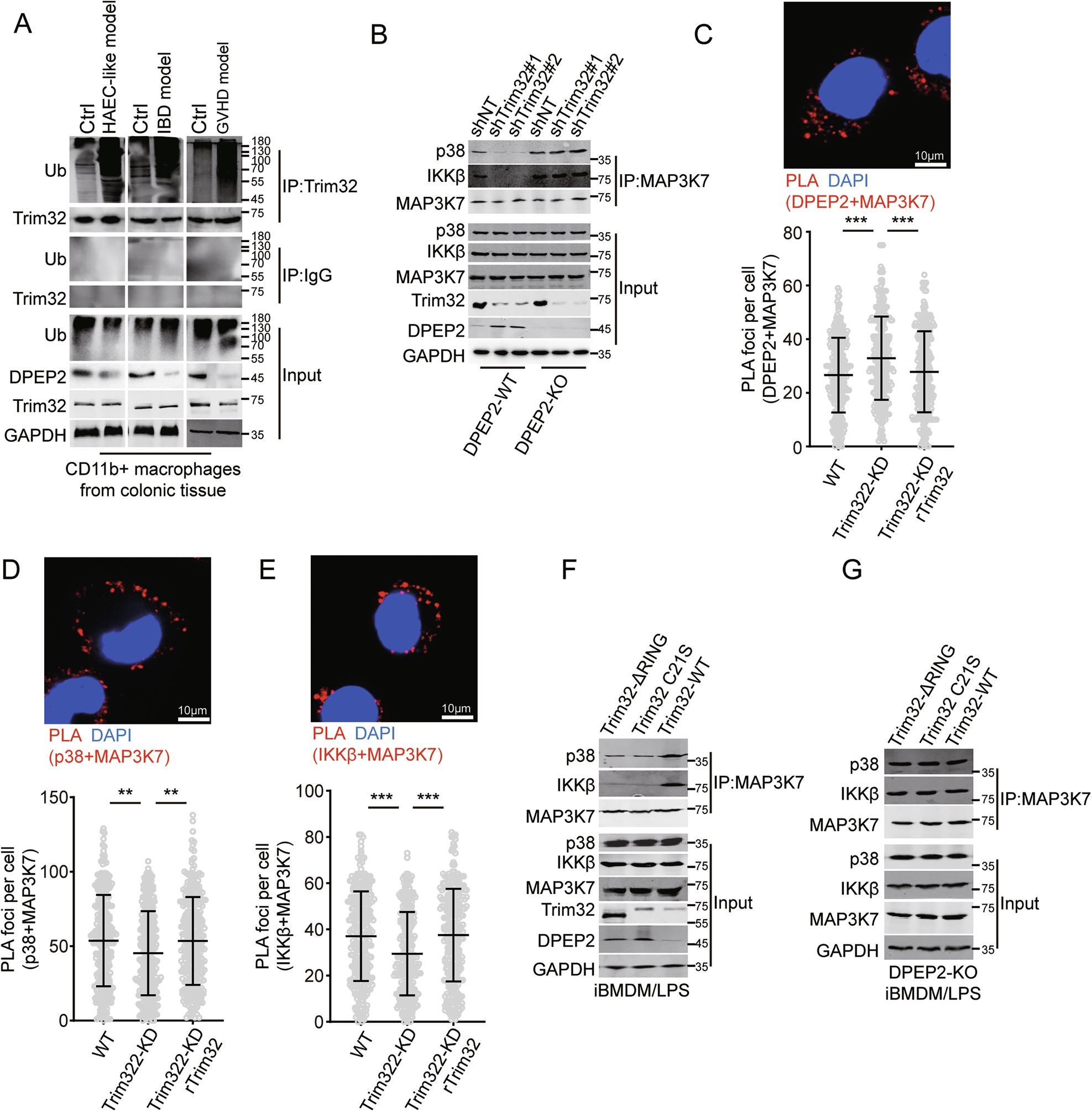 Fig. 7: Inhibition of Trim32 represses transduction of NF-κB and p38 signalings by DPEP2-mediated MAP3K7 inactivation.