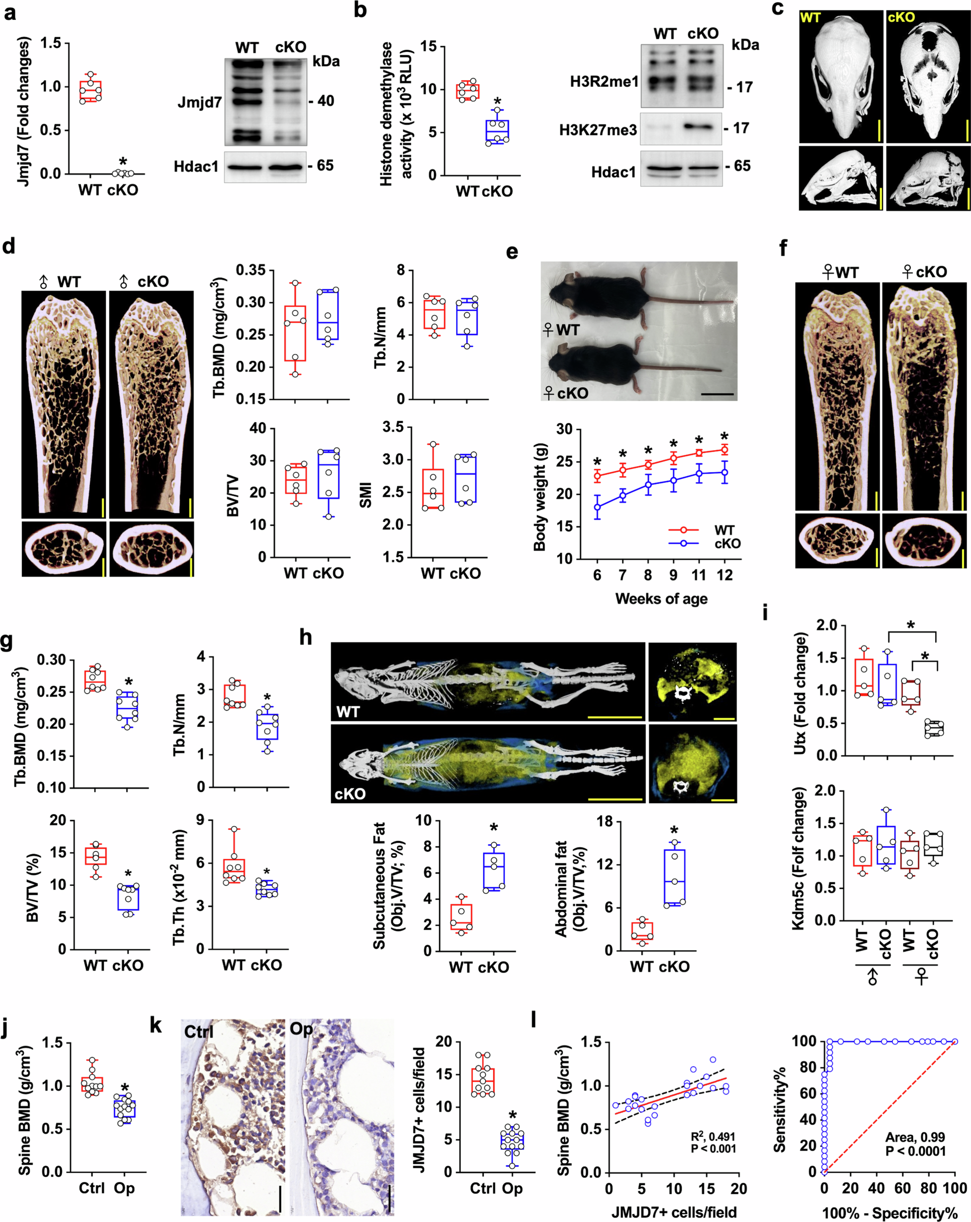Fig. 1: Comprehensive analysis of bone microstructure and body fat in osteoblast-specific Jmjd7 knockout (Jmjd7KO) mice and JMJD7 expression in human bone biopsies.
