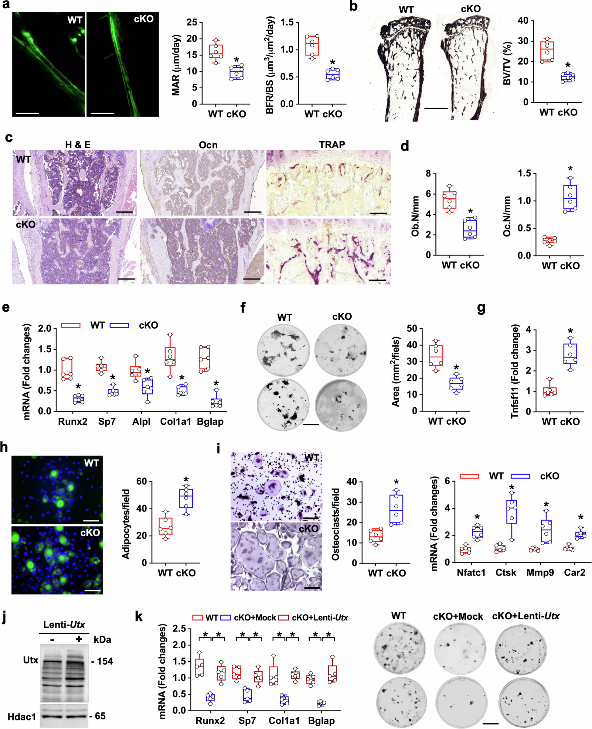 Fig. 3: Bone histomorphometry and differentiation potential in Jmjd7KO mice.