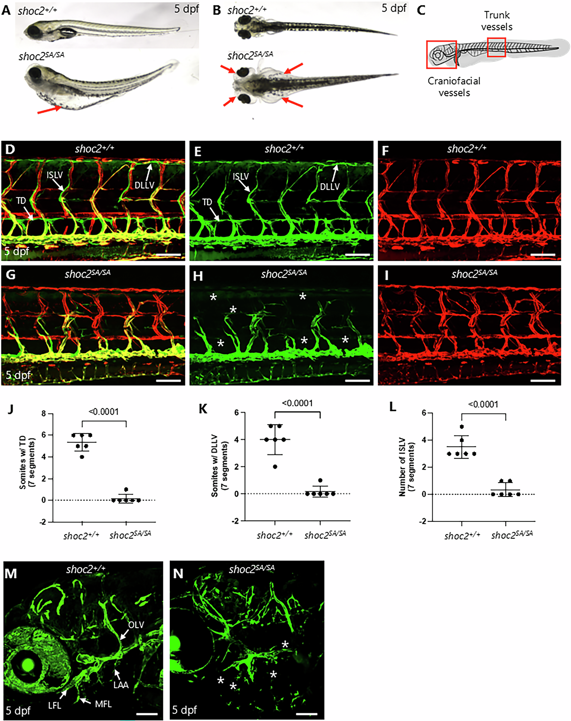 Fig. 1: Loss of lymphatics in shoc2 mutant zebrafish.