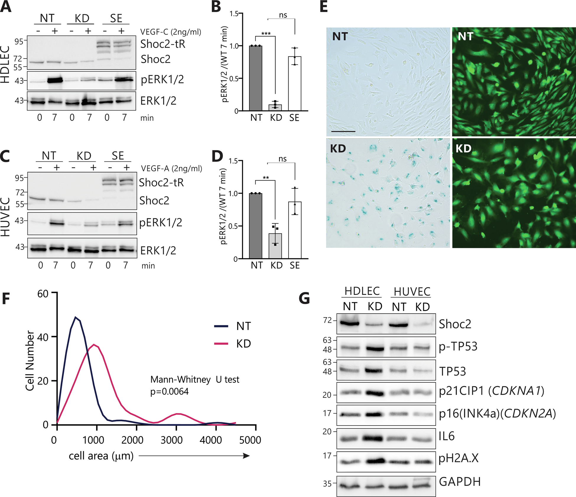 Fig. 3: Shoc2-dependent activation of the ERK1/2 pathway in endothelial cells.