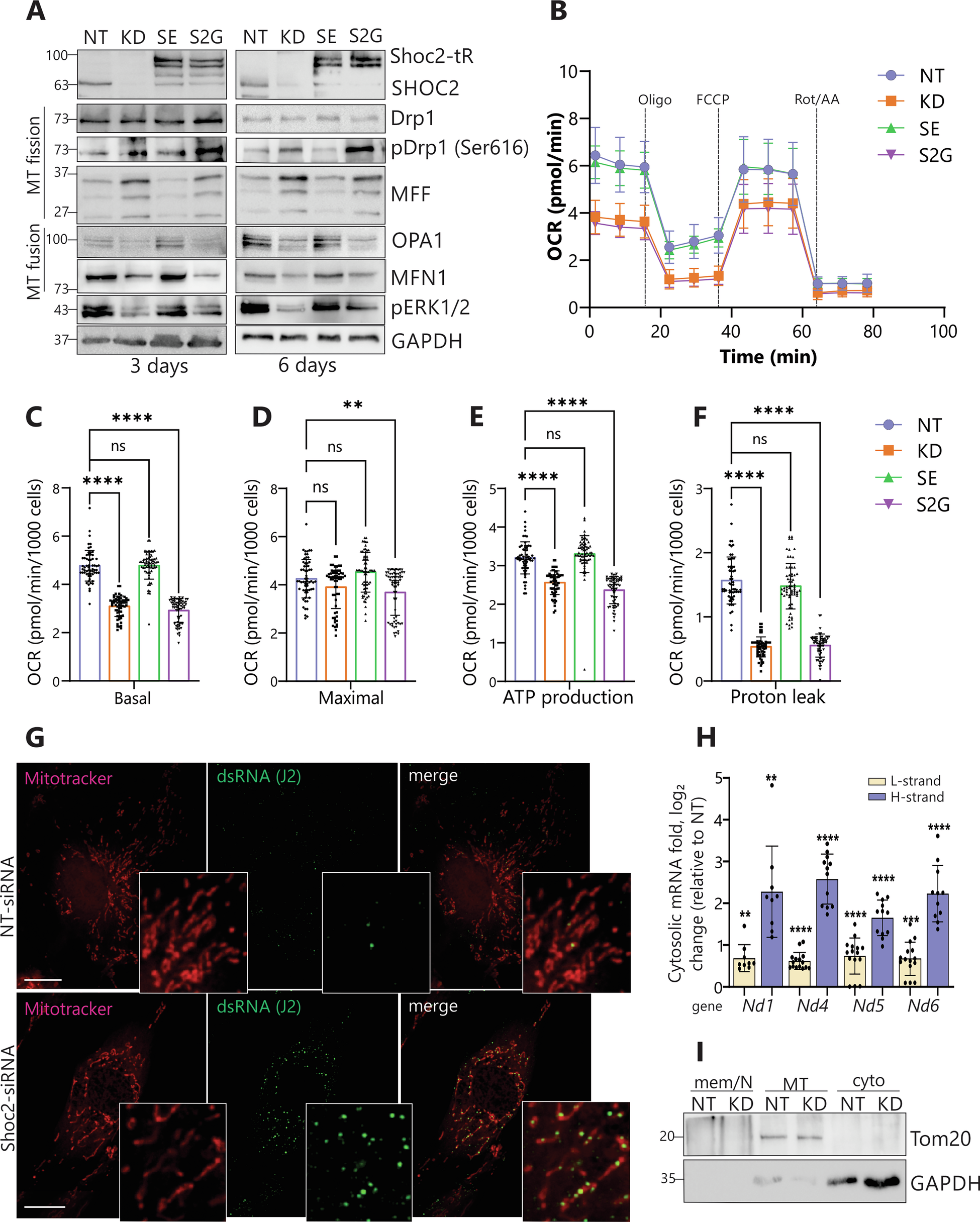 Fig. 7: Mitochondrial changes in Shoc2-depleted HDLEC.