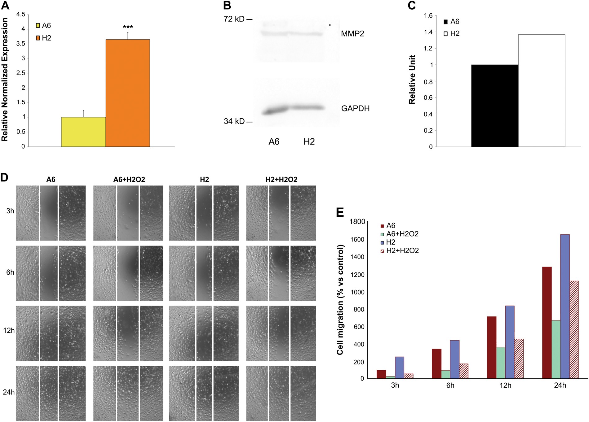 Fig. 5: Different amount of MMP2 in cell clone and A6 cells