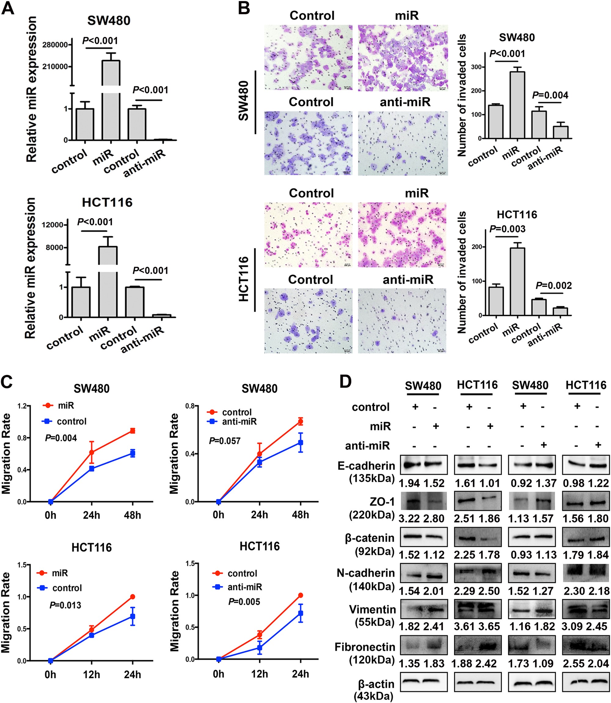 Fig. 3: Overexpression of miR-105 promoted aggressive phenotypes of CRC cells in vitro
                                    