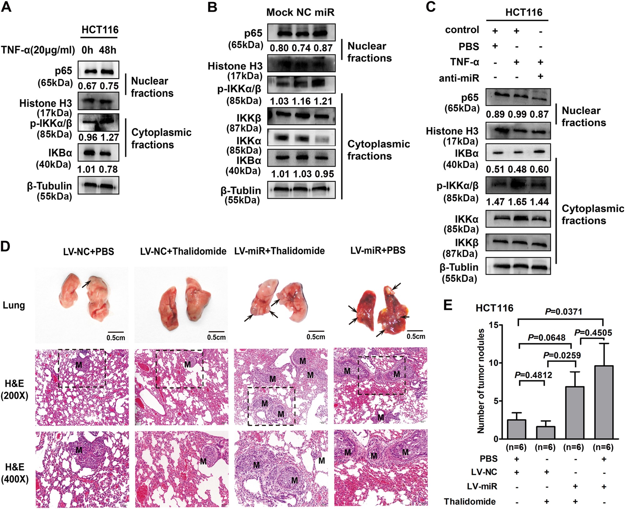 Fig. 4: miR-105-mediated TNF-α-induced EMT in a NF-κB-dependent manner in CRC cells