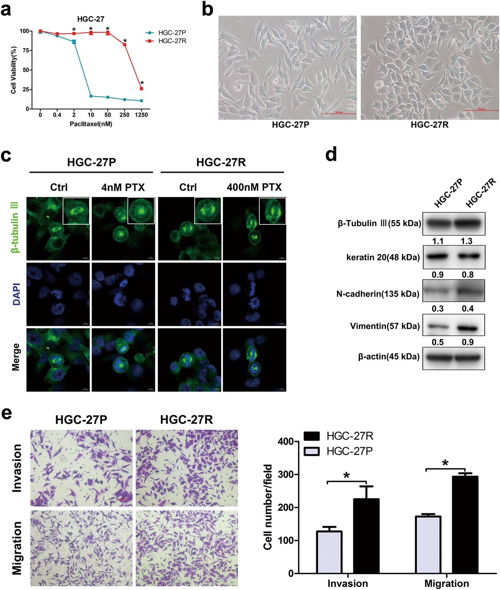 Fig. 1: Altered morphology, microtubular disorders, and EMT in PTX-resistant GC cells.