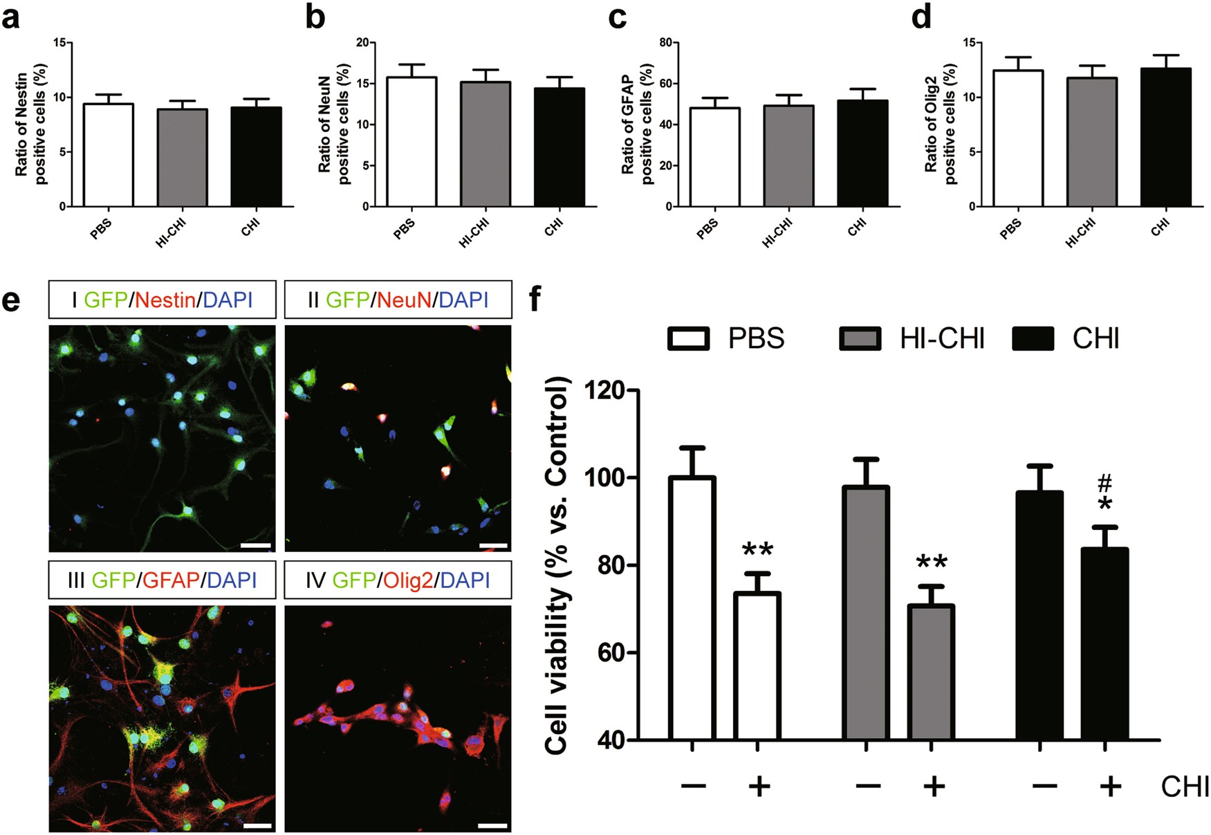 Fig. 1: Effects of pre-treatment with CHI mouse serum on iNSC differentiation and the survival of differentiated iNSCs