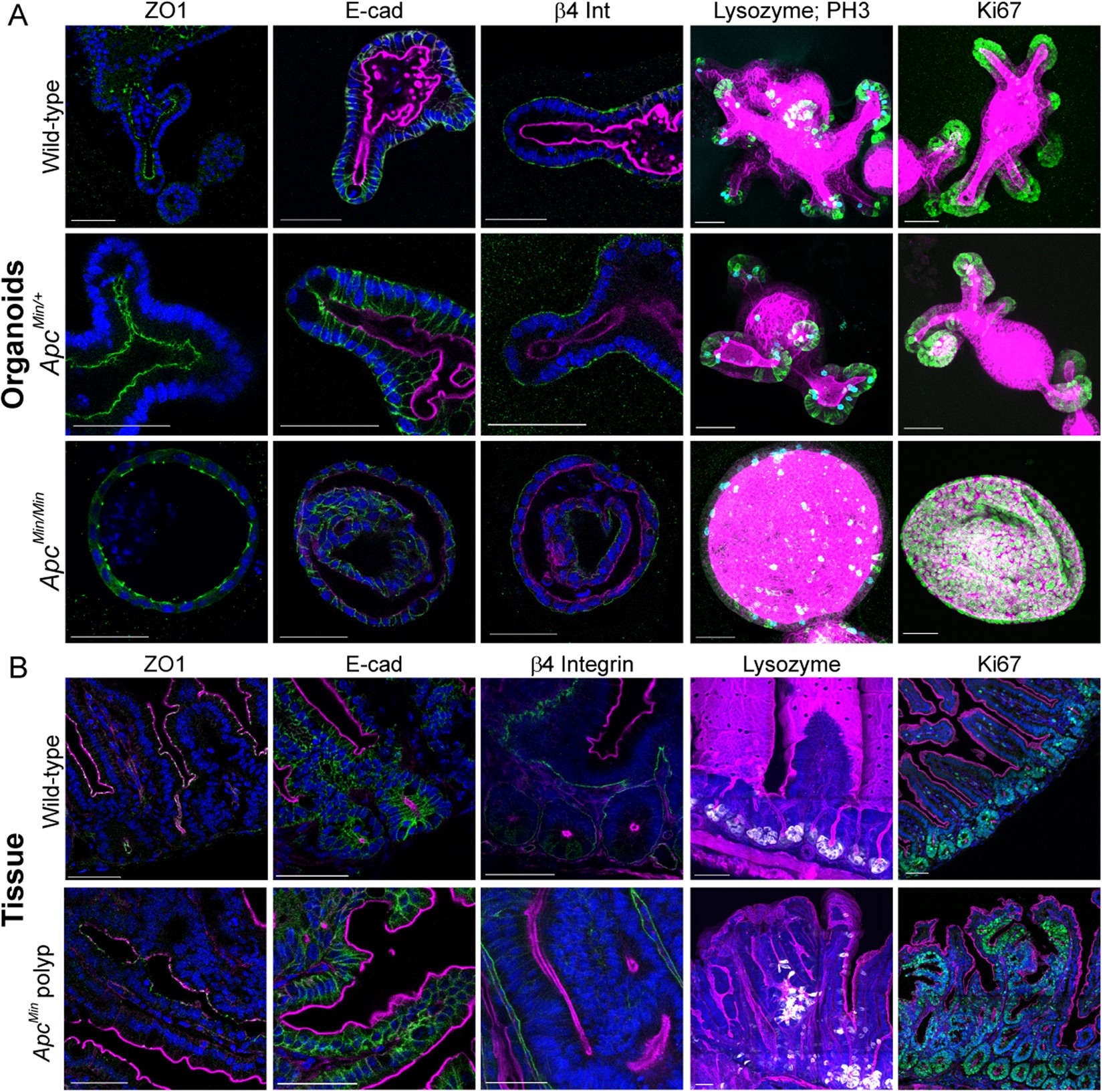 Bcl9 and Pygo synergise downstream of Apc to effect intestinal neoplasia in  FAP mouse models