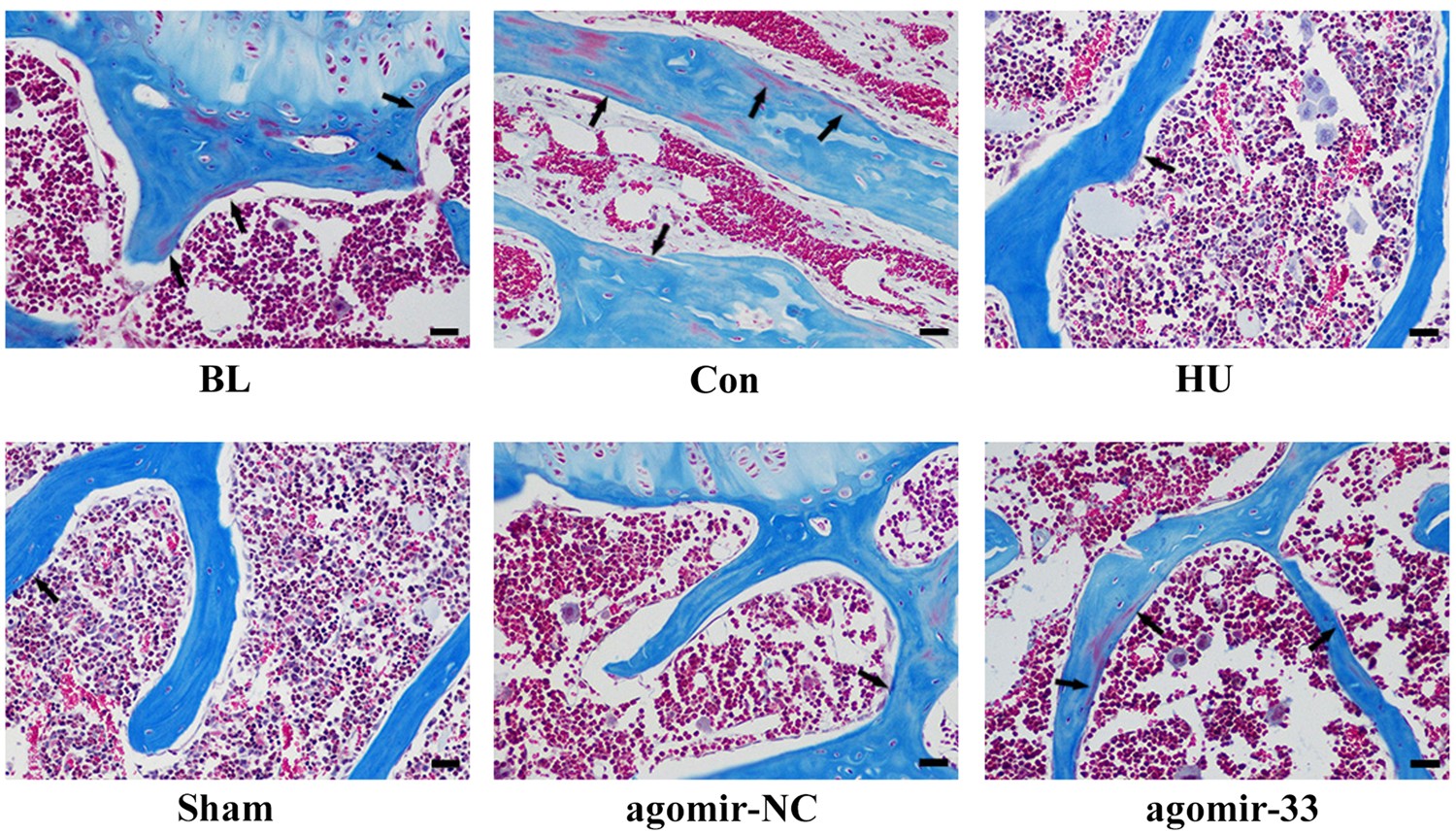Fig. 5: miR-33-5p displays protective effects on the bone morphology of distal femurs by Masson’s trichrome staining.