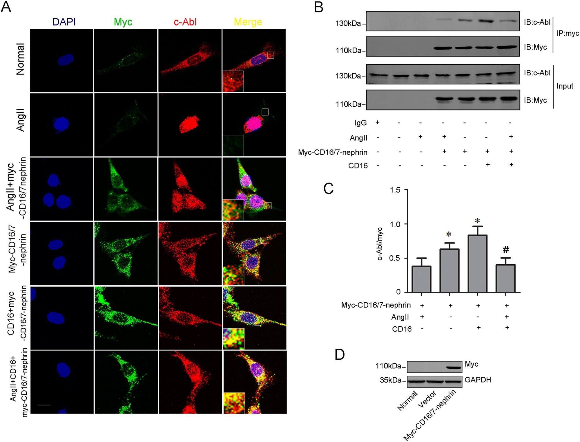 Fig. 2: Phosphorylated nephrin recruites c-Abl in cultured podocytes.