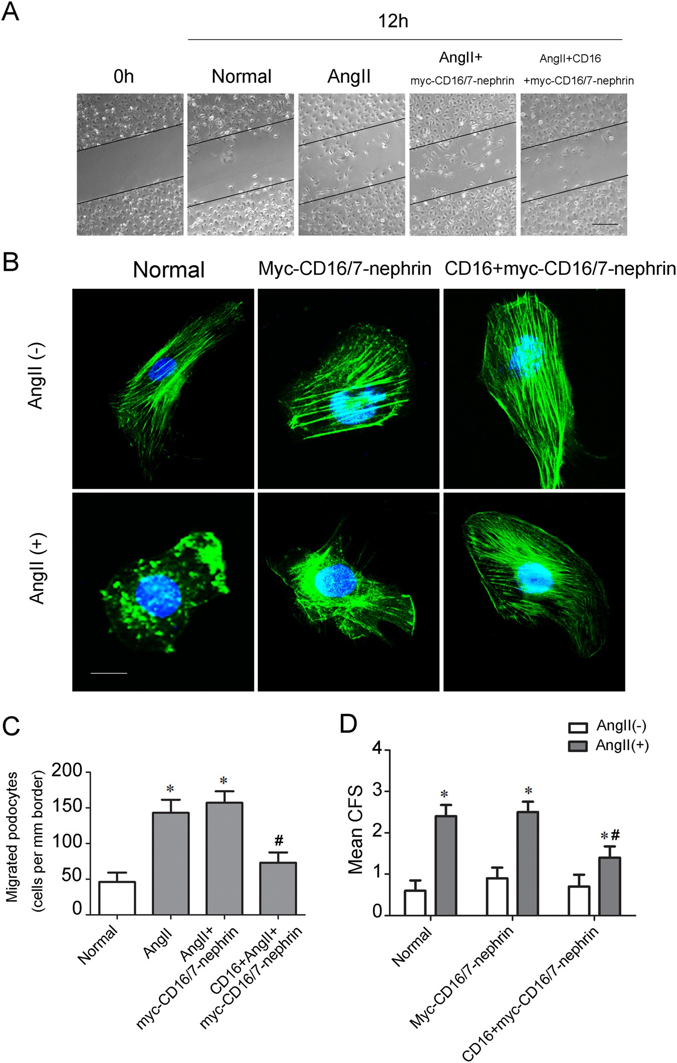 Fig. 3: Nephrin phosphorylation restores Ang II-induced podocyte cytoskeleton reorganization.