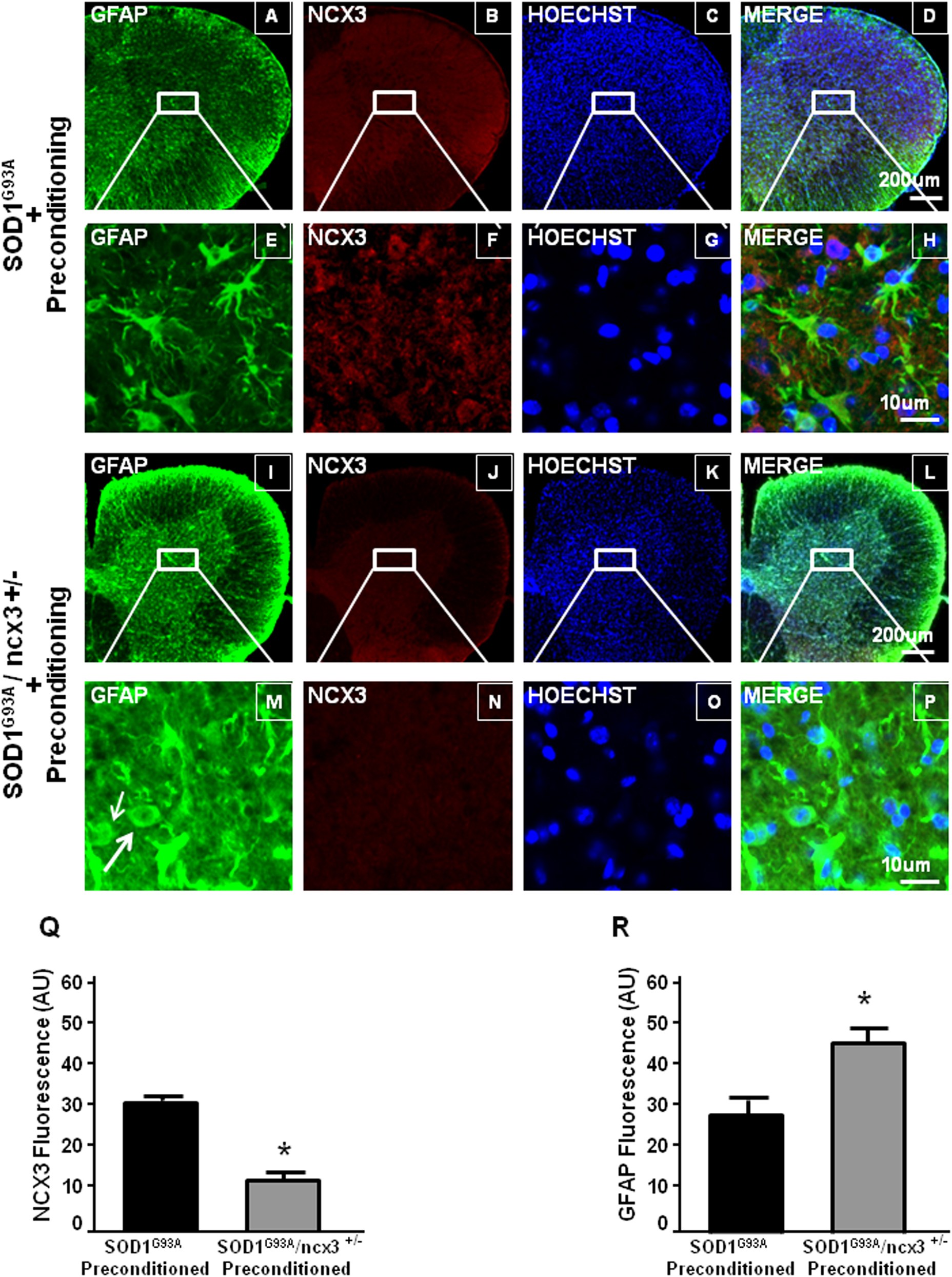 Fig. 5: Contribution of NCX3 on astroglyosis reduction induced by l-BMAA-PC.
