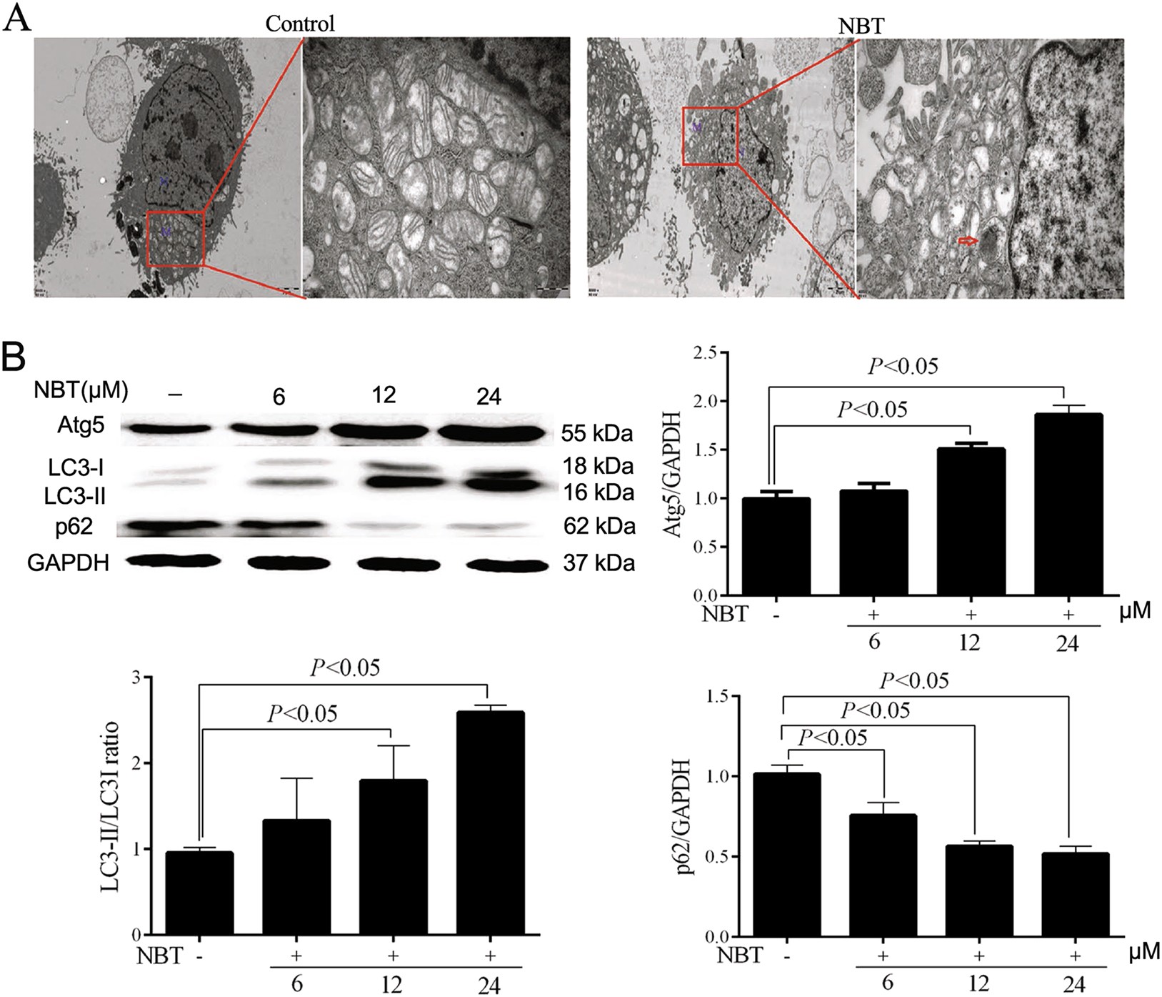 Fig. 5: NBT induced autophagic flux in MCF-7 cells.