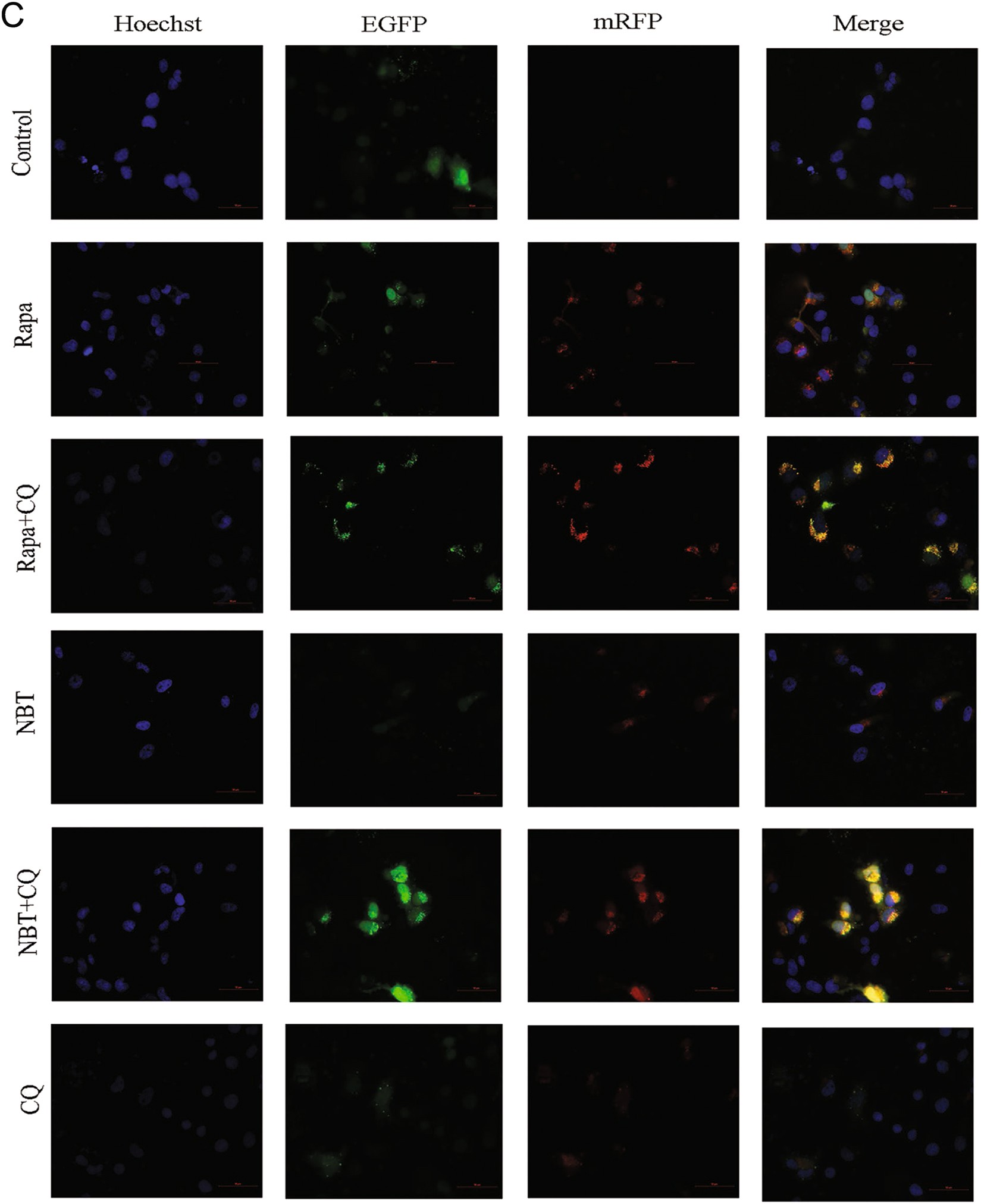Fig. 5: NBT induced autophagic flux in MCF-7 cells.