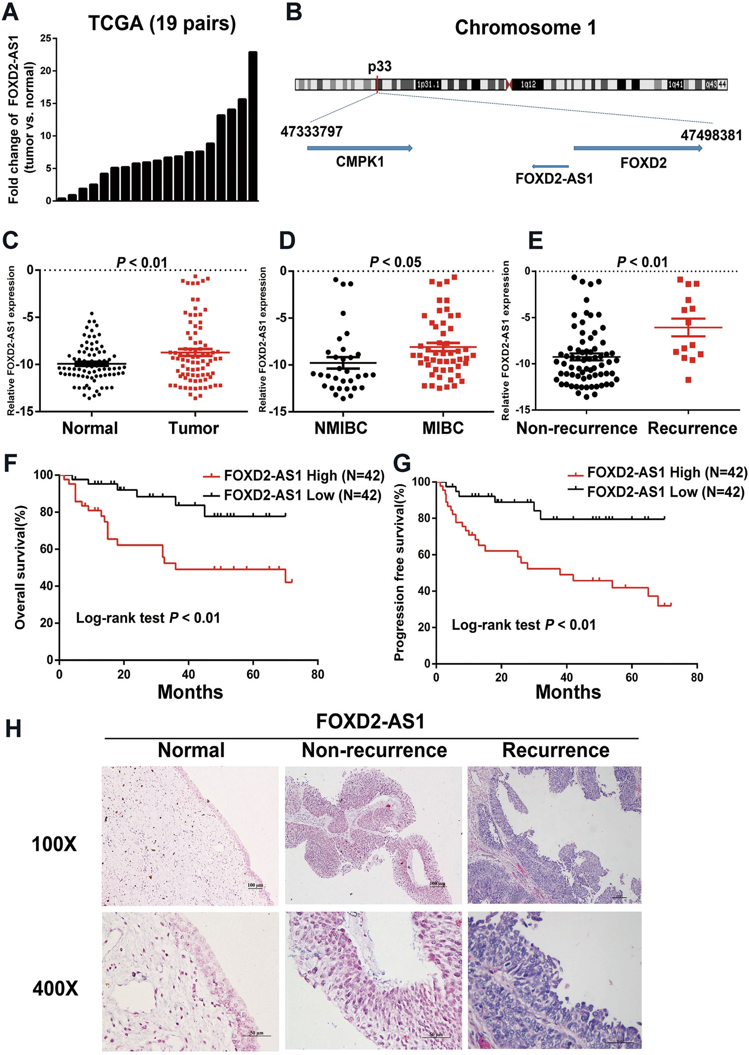 The long non-coding RNA FOXD2-AS1 promotes bladder cancer progression and  recurrence through a positive feedback loop with Akt and E2F1 | Cell Death  & ...