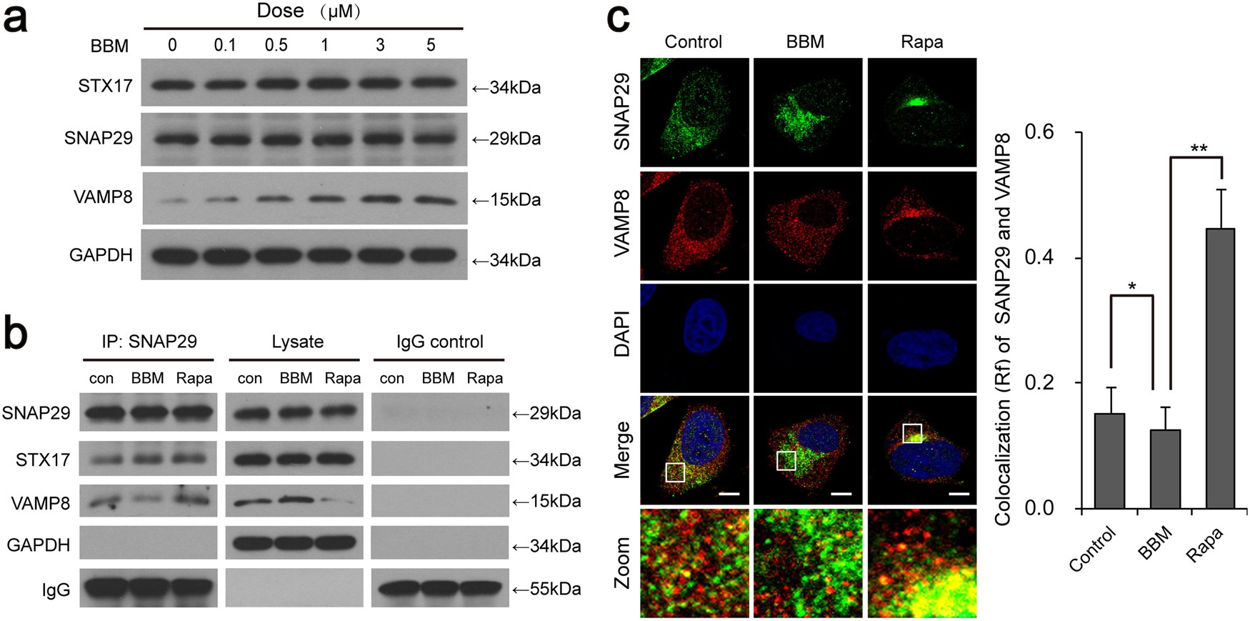 Fig. 4: BBM blocks the formation of STX17–SNAP29–VAMP8 complex by inhibiting the interaction of SNAP29 and VAMP8.