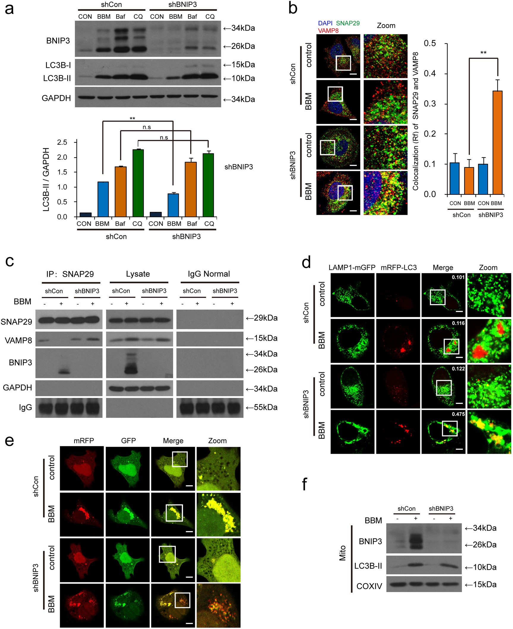 Fig. 6: Knocking down BNIP3 attenuates BBM-mediated blockade of autophagosome-lysosome fusion.