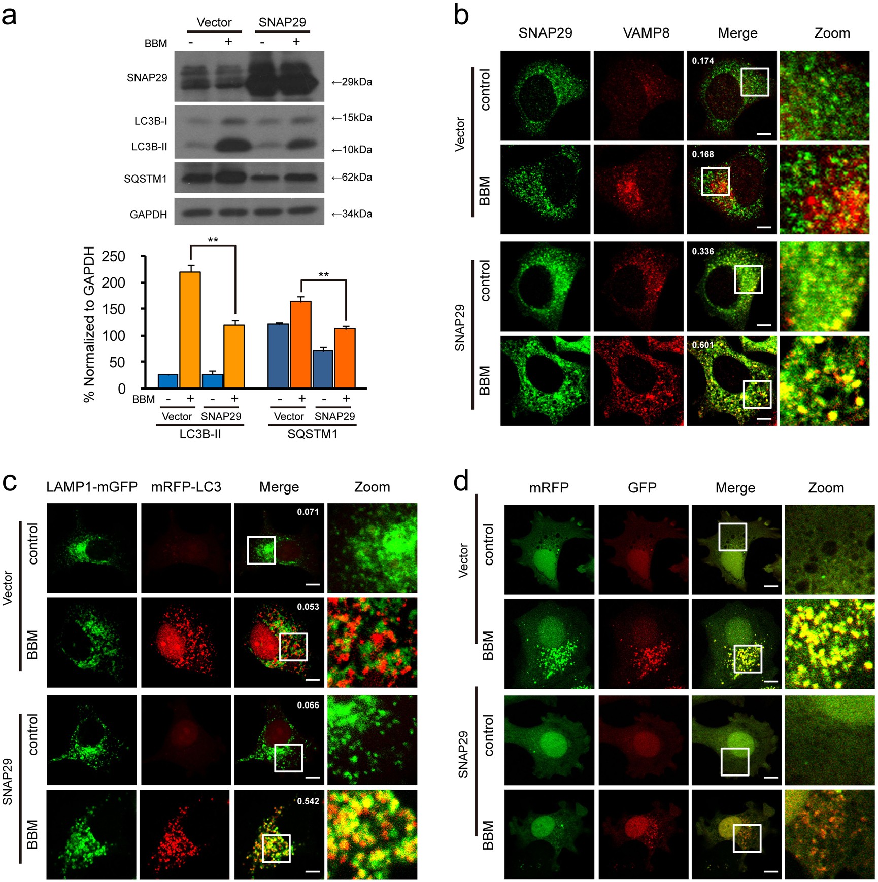 Fig. 8: SNAP29 overexpression attenuates BBM-mediated blockade of autophagosome-lysosome fusion.