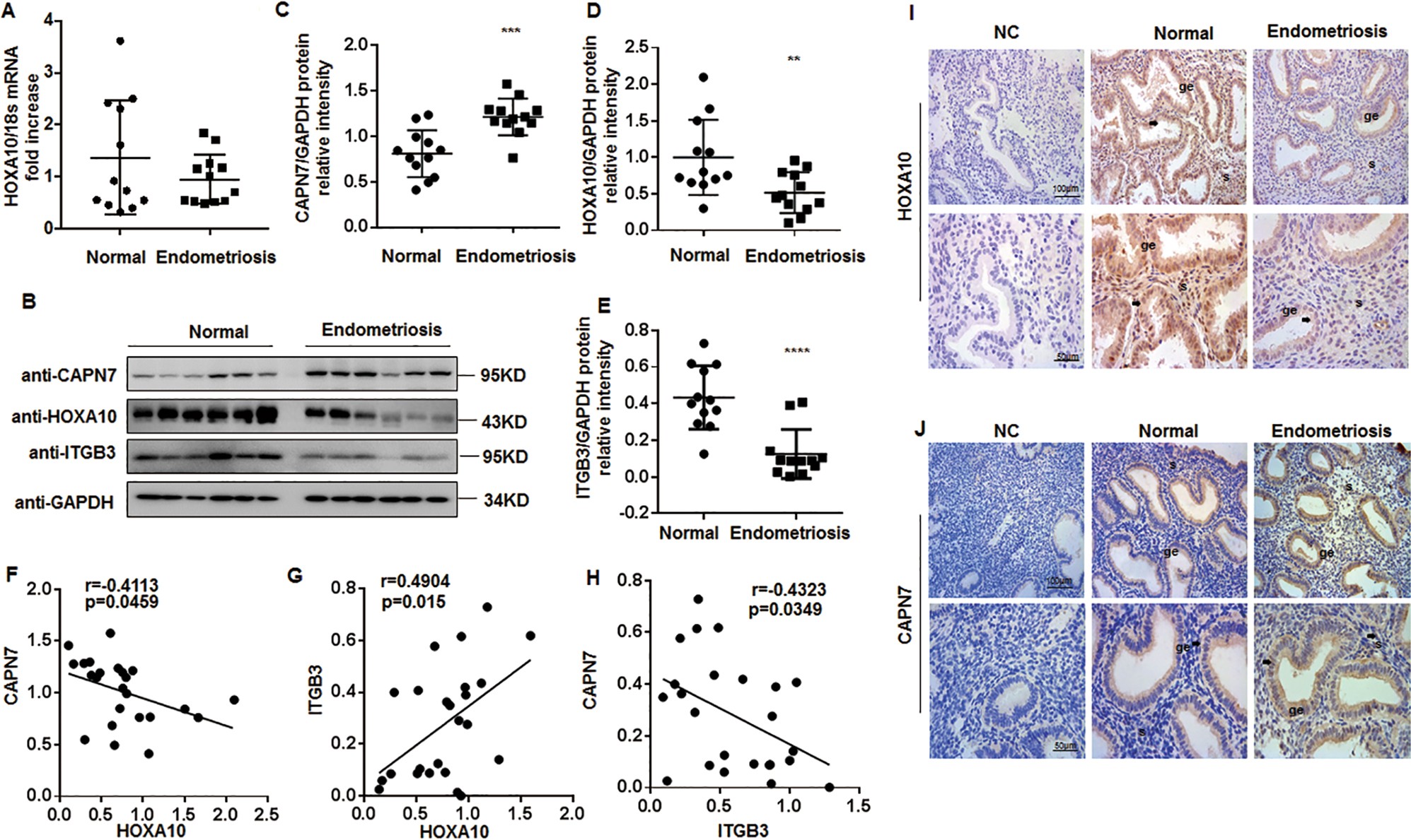 Fig. 7: Aberrant overexpression of CAPN7 in the endometrium of women with ENDO.
