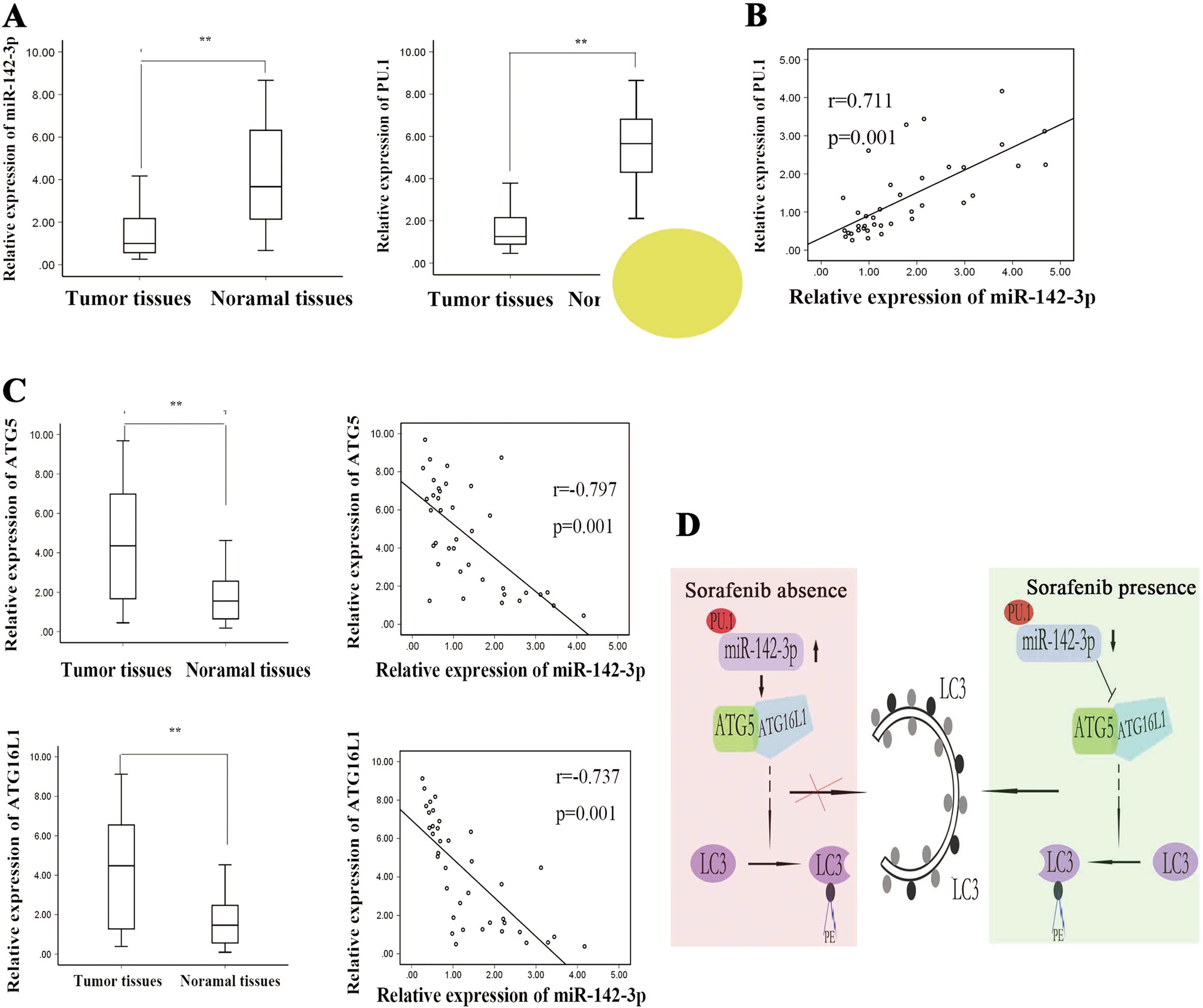 Fig. 8: miR-142-3p expression was positively correlated with PU.1 expression and negatively correlated with ATG5/ATG16L1 expression in HCC tissues.