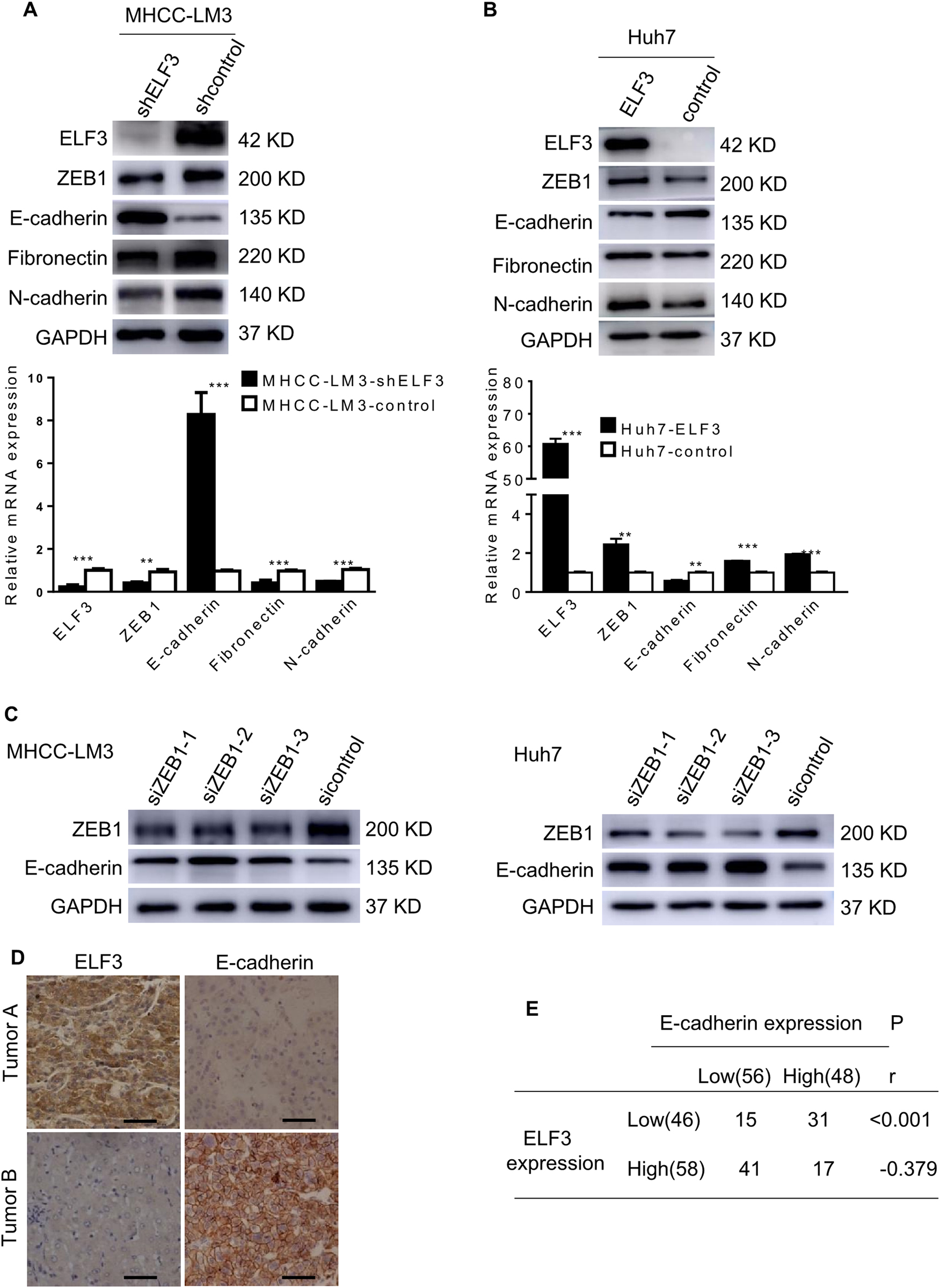 Fig. 4: ELF3 promotes EMT by regulating ZEB1 activation in HCC cells.