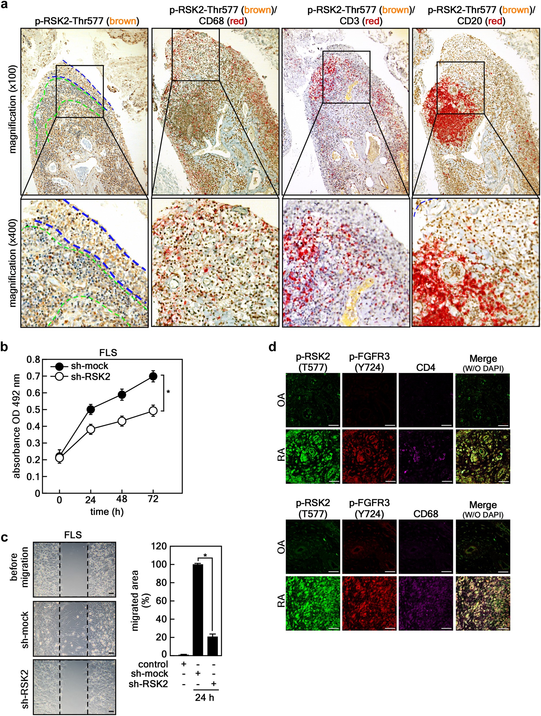 Fig. 2: Involvement of FGFR3 and RSK2 in RA in humans.