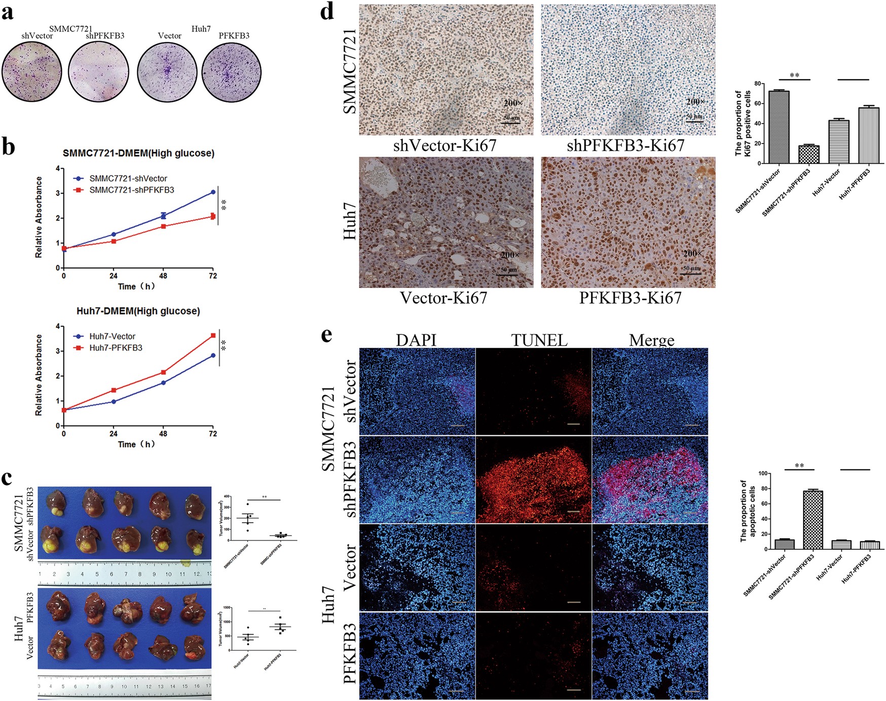 Fig. 2: PFKFB3 expression in HCC cells promoted tumor growth in vitro and in vivo.