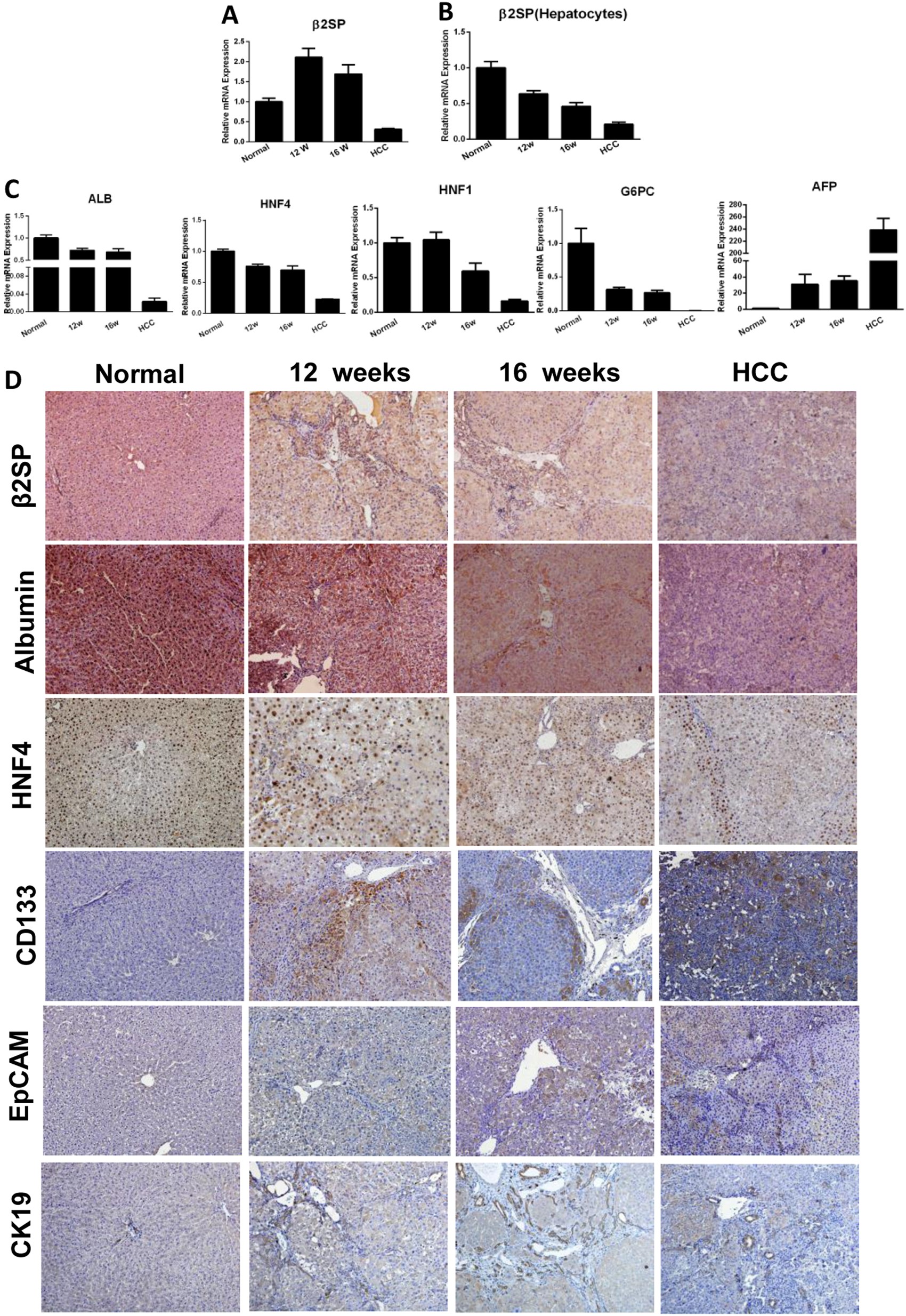 Fig. 2: β 2 spectrin expression correlated with hepatocyte differentiation in DEN-induced rat model of liver fibrosis and HCC.