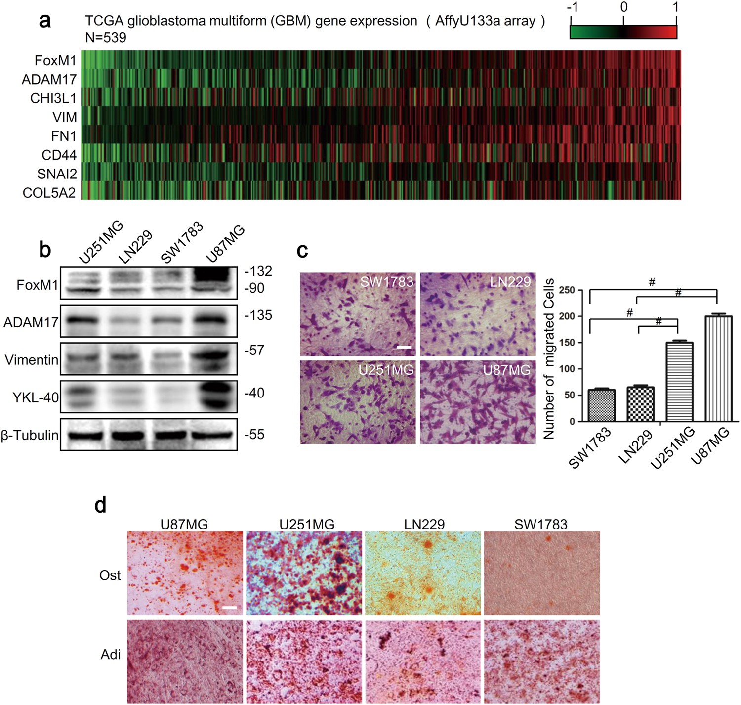 Human Gene ADAM17 (ENST00000310823.8) from GENCODE V43