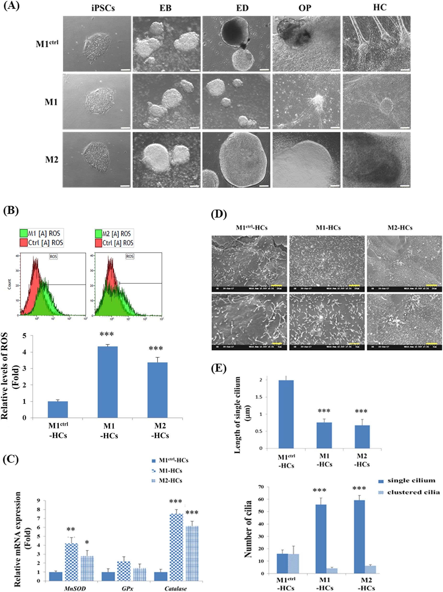 Fig. 3: Morphological characterisation of HC-like cells from hiPSCs harbouring the A8344G mutation of mtDNA.
