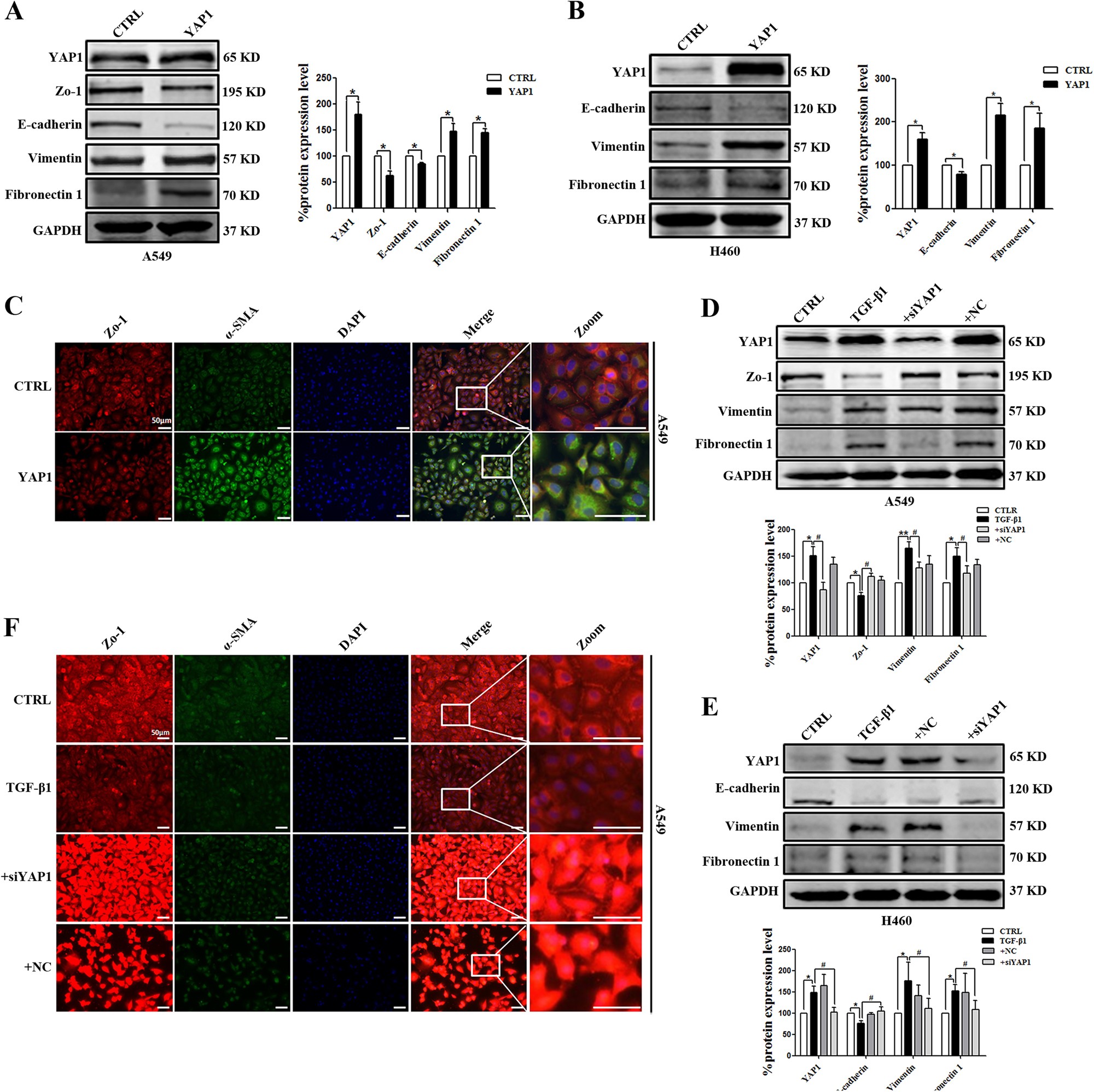 Fig. 3: EMT-related marker expression in A549 cells with YAP1 overexpression or silencing.