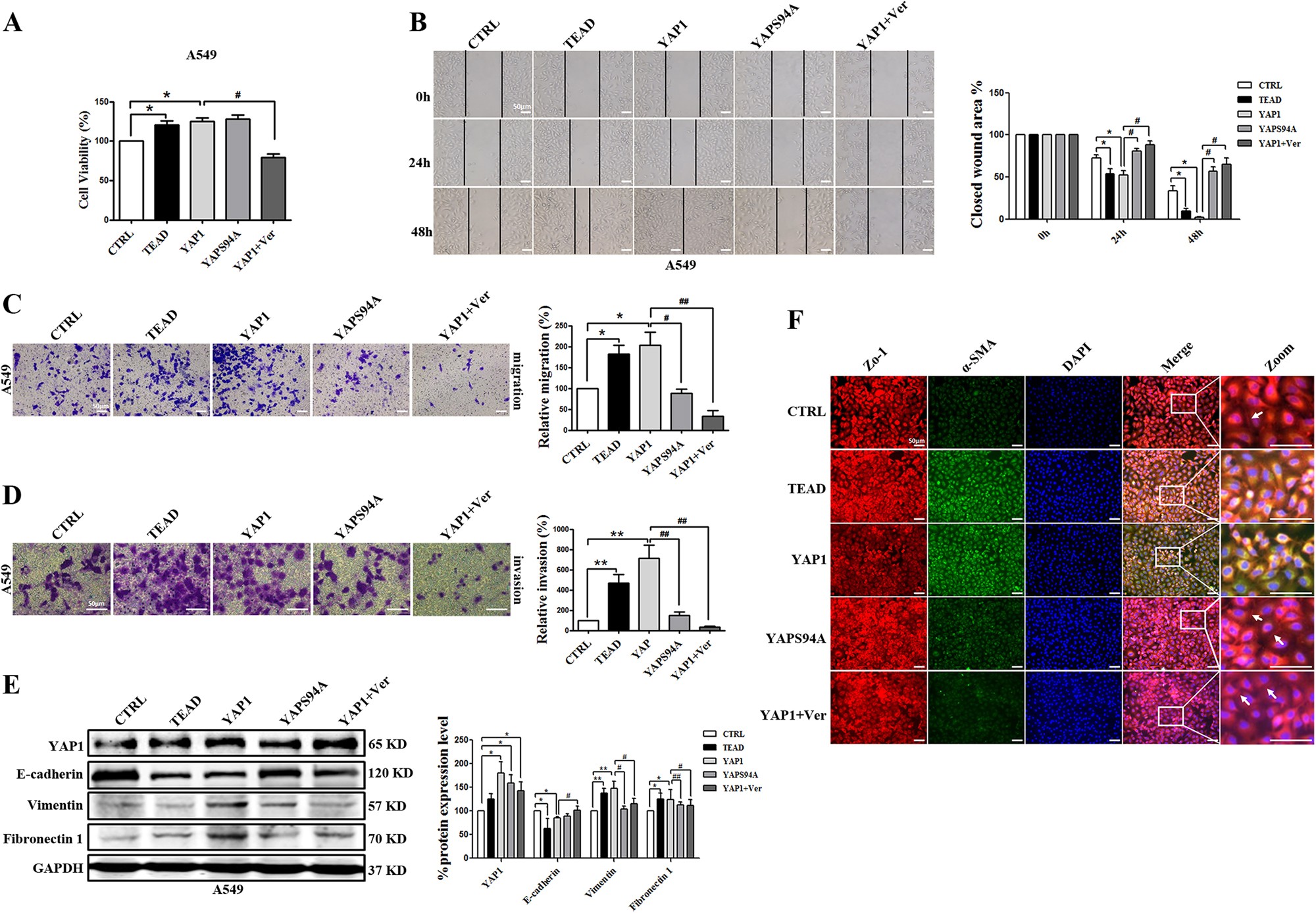 Fig. 4: TEAD is involved in YAP1-induced EMT in A549 cells.