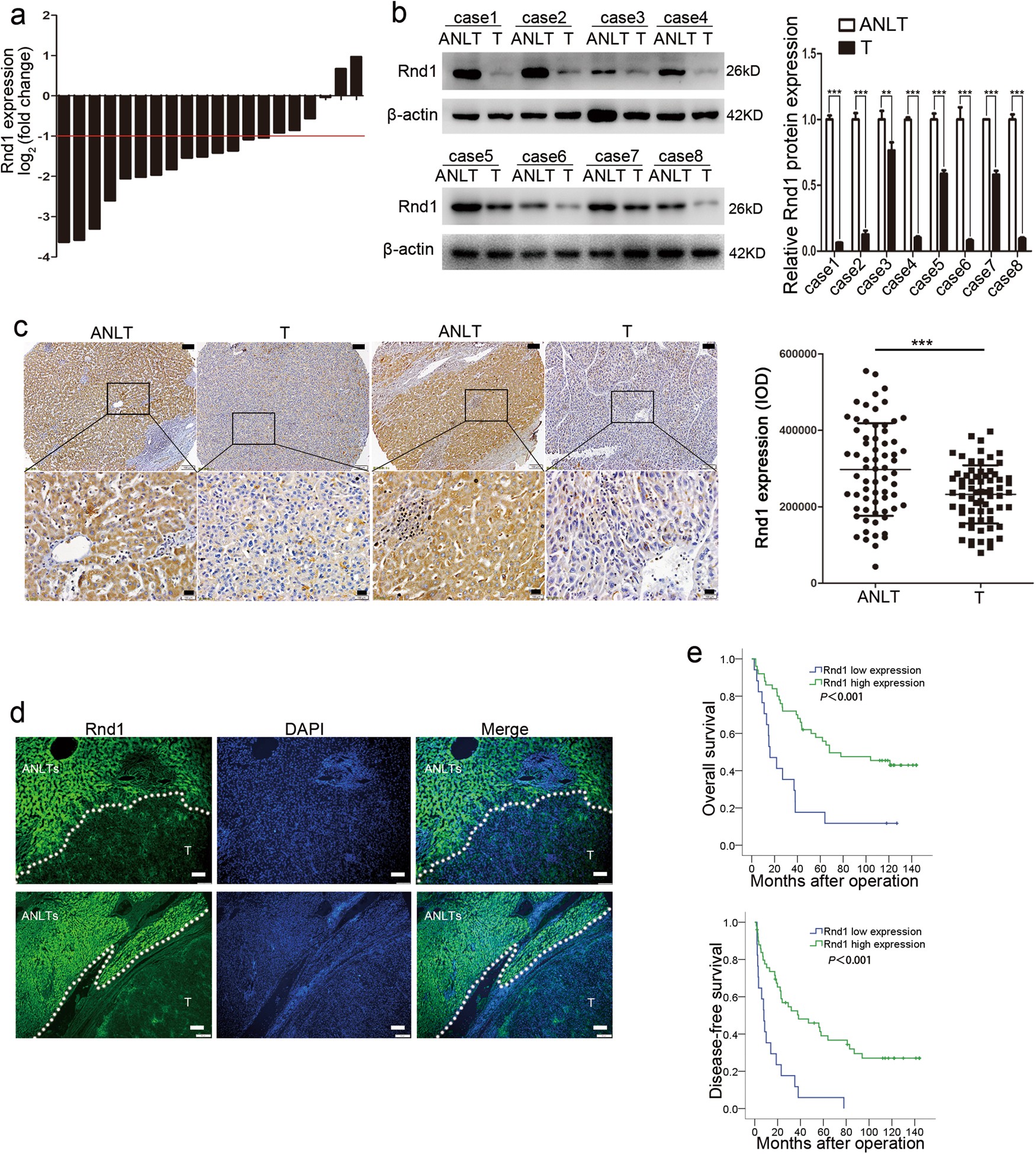 Fig. 1: Rnd1 expression is downregulated in HCC and predicts poor prognosis.