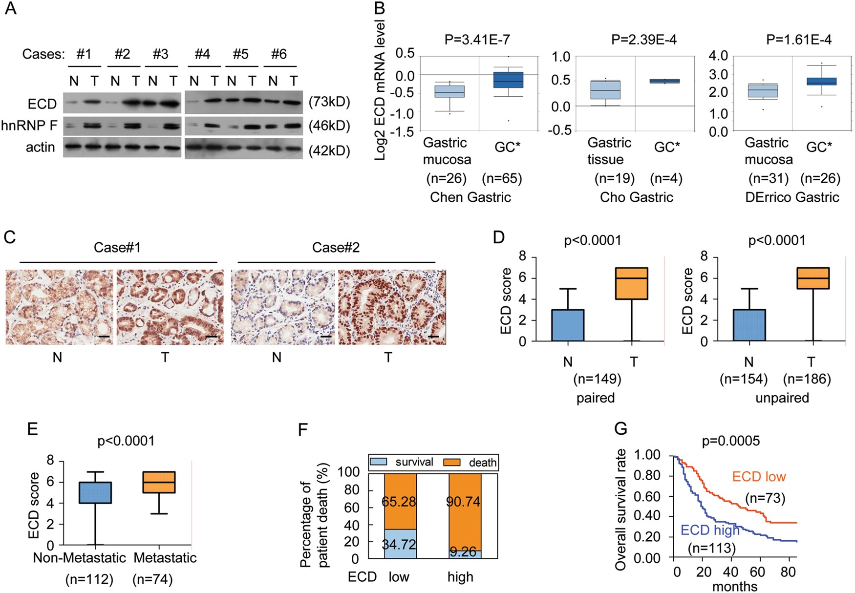 Fig. 1: ECD expression is increased in GC and is correlated with a poor prognosis in GC patients.