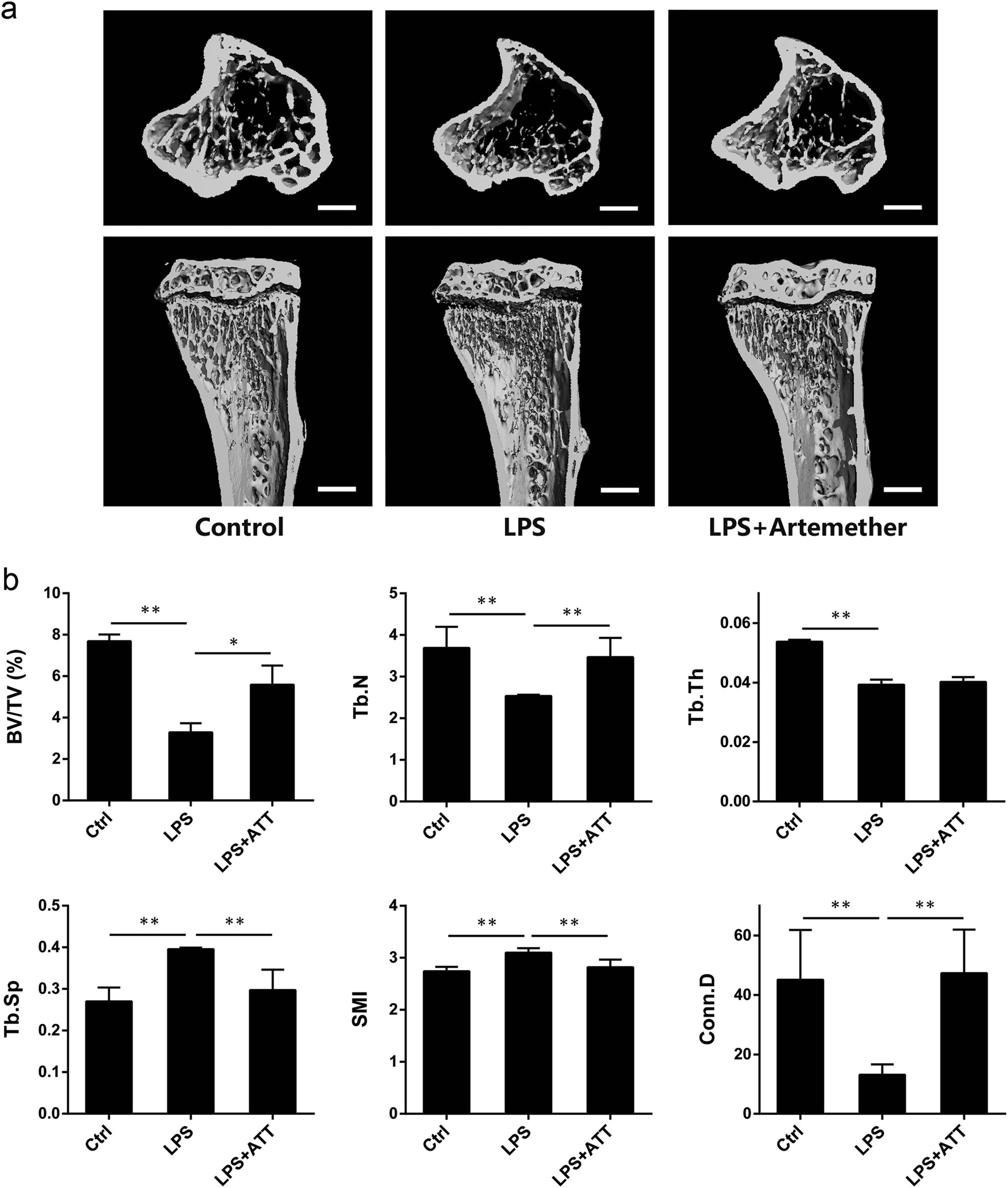 Fig. 5: Artemether mitigated inflammatory bone erosion in a murine tibial model of LPS-induced inflammatory bone loss.