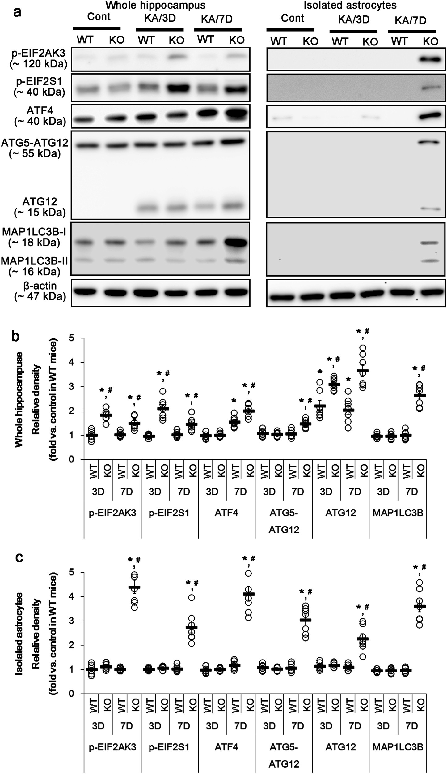 Fig. 2: KA-induced ER stress and autophagy.
