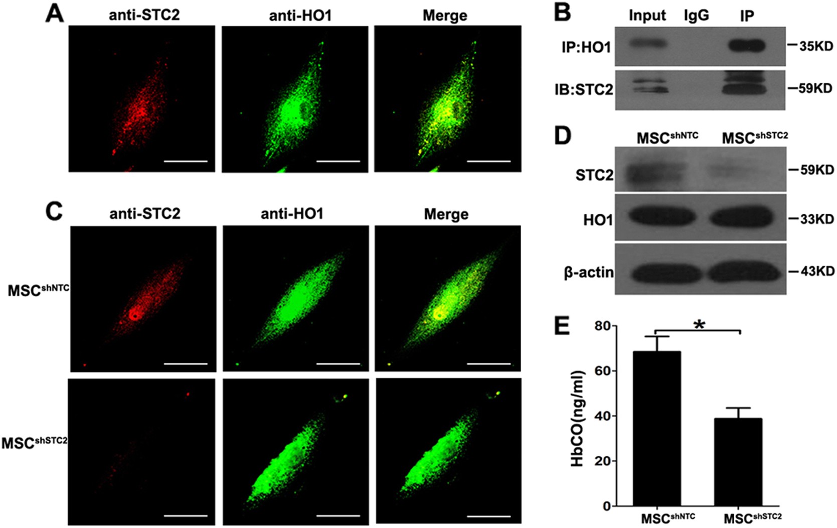 Fig. 5: Silence of STC2 in MSCs impaired the activity of HO-1.