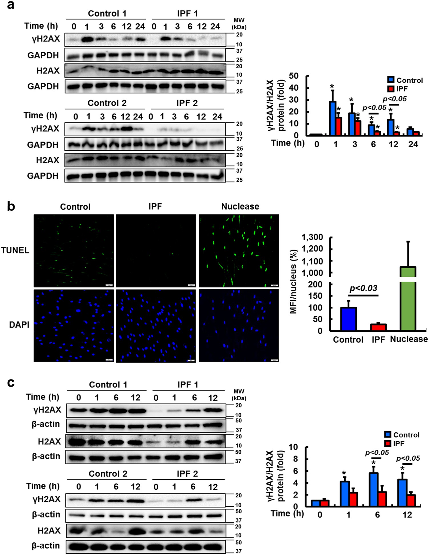 Fig. 2: IPF fibroblasts show lower γH2AX expression and decreased DNA fragmentation following irradiation or bleomycin treatment.