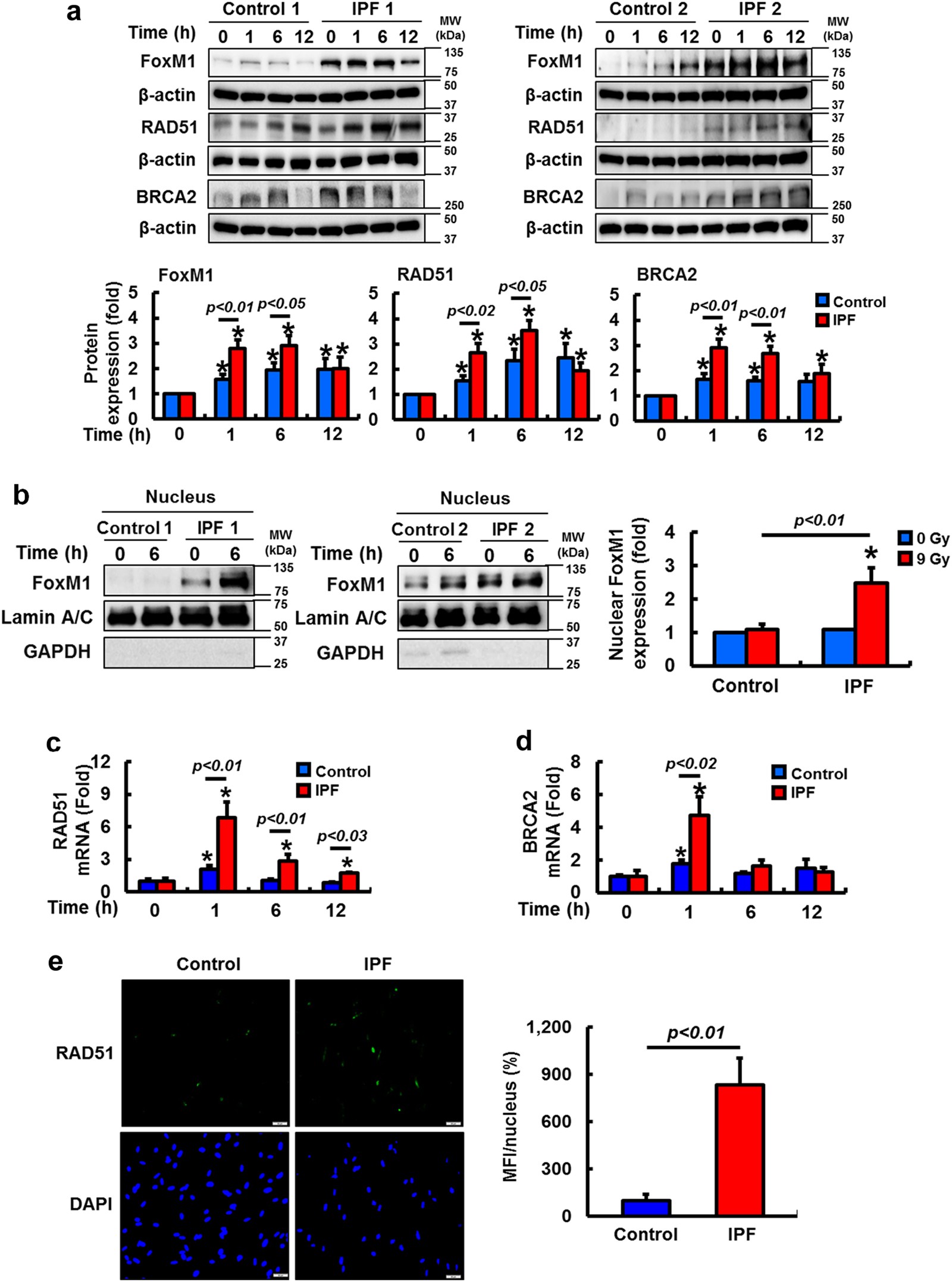 Fig. 3: Radioresistant IPF fibroblasts upregulate FoxM1, RAD51, and BRCA2 following exposure to radiation.