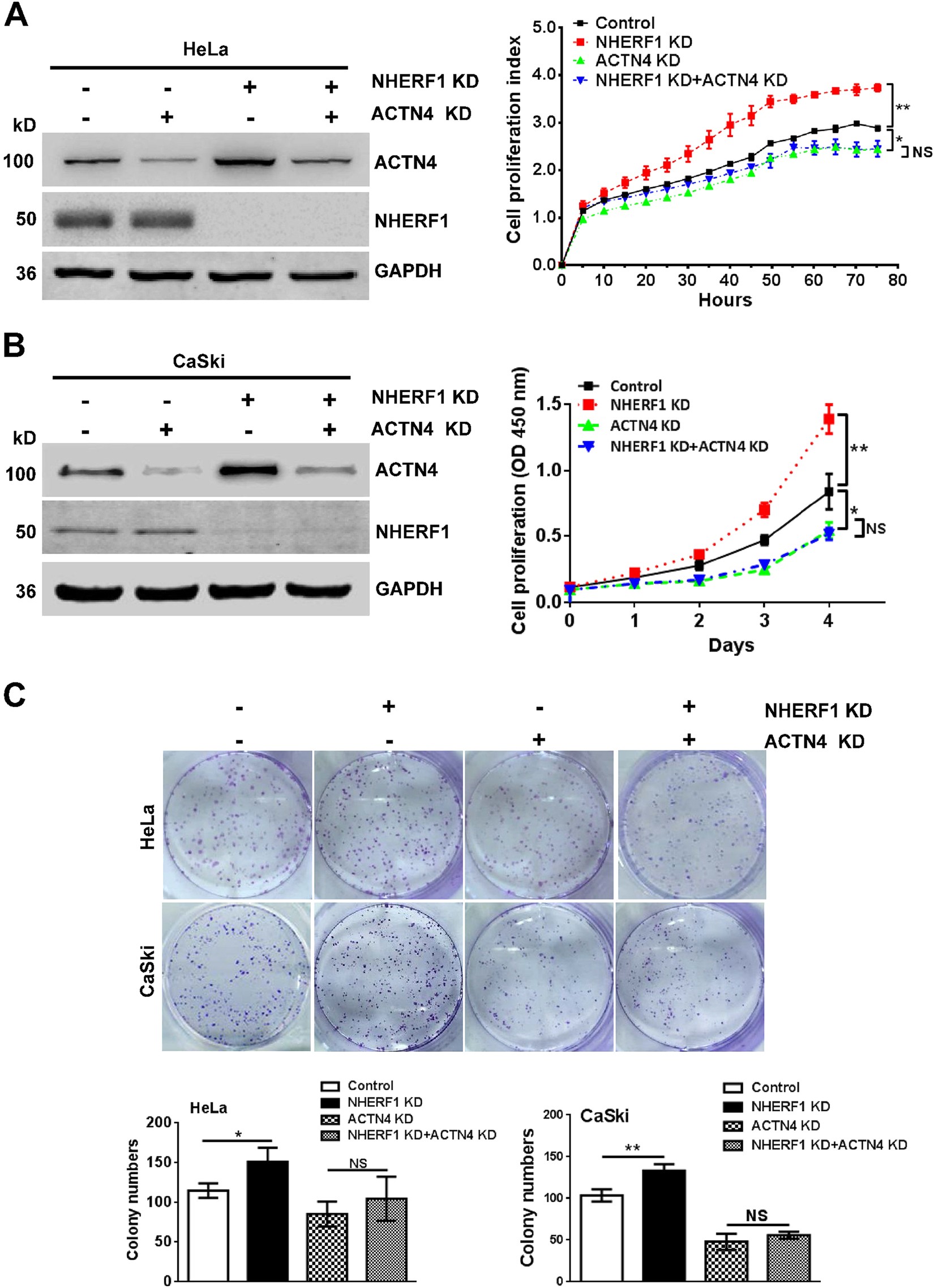 Fig. 3: NHERF1 inhibits proliferation of cervical cancer cells through downregulation of ACTN4 expression.