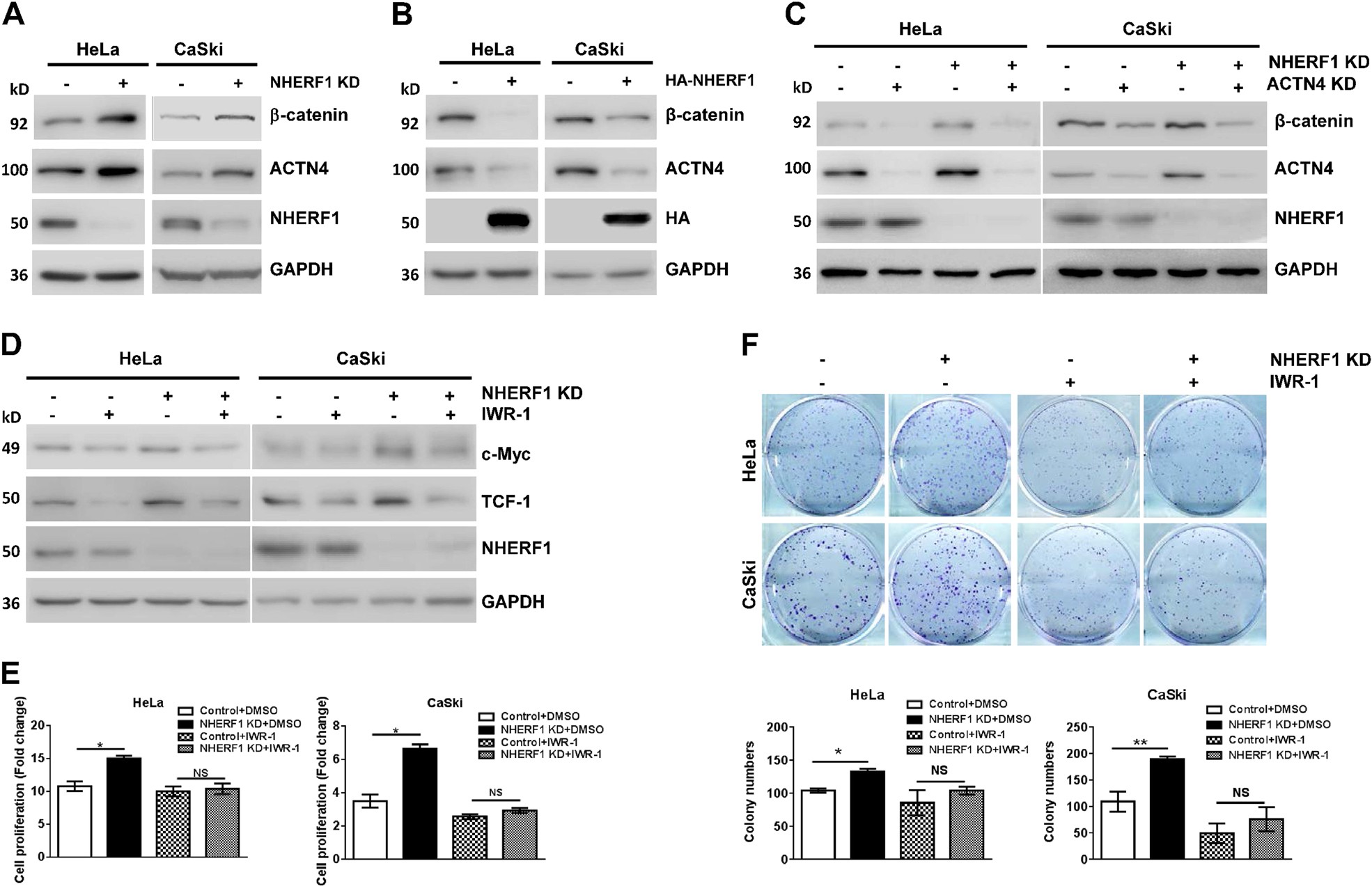 Fig. 4: NHERF1 suppresses proliferation of cervical cancer cells through inhibition of Wnt/β-catenin pathway activation via ACTN4.