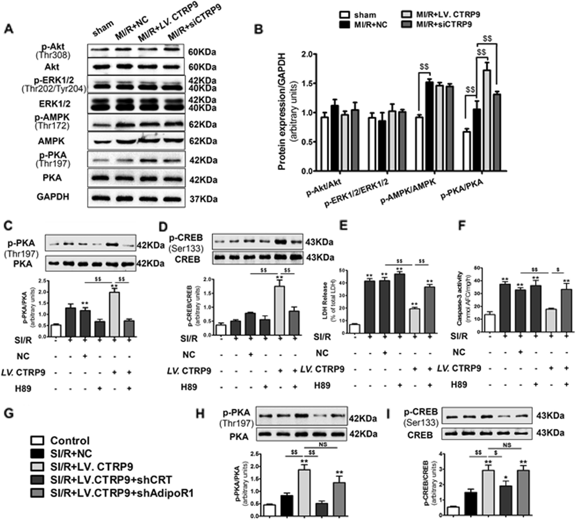 Fig. 6: The PKA–CREB axis acts as the downstream of CTRP9–CRT interaction in MI/R injury.