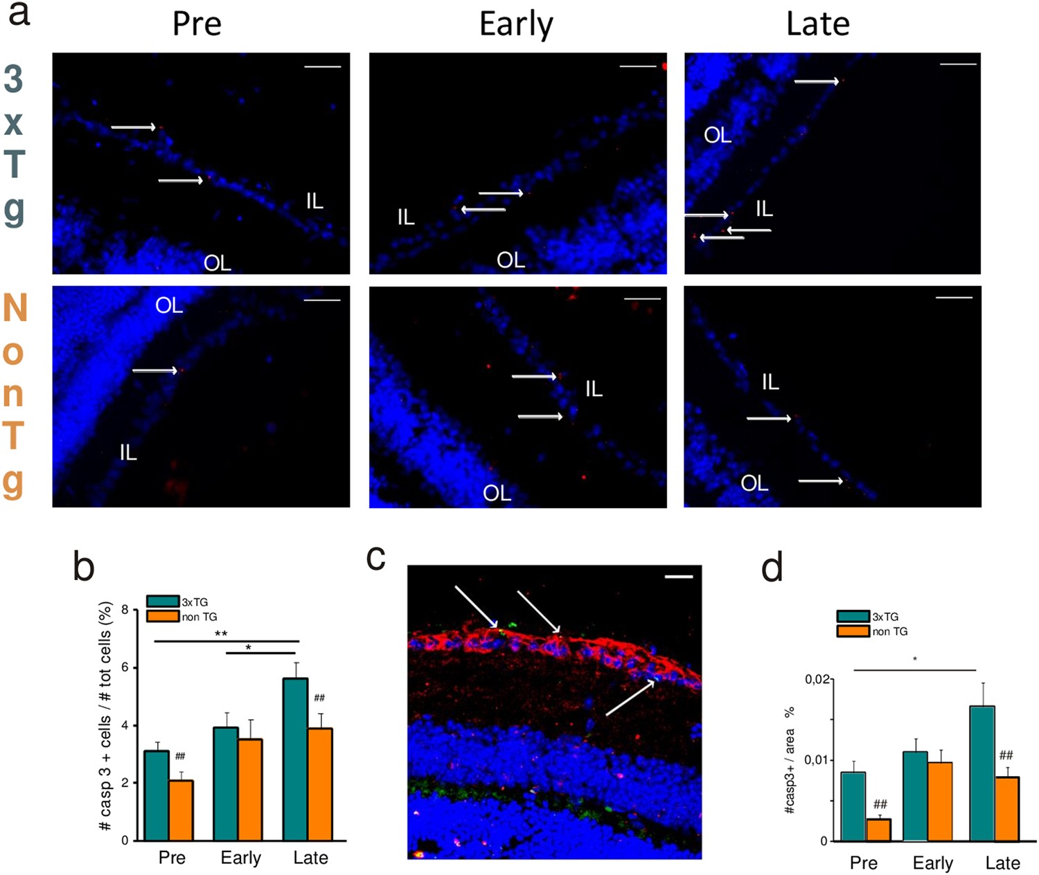 Fig. 1: Retinal neurodegeneration starts at pre-symptomatic stage in 3xTg-AD mice.