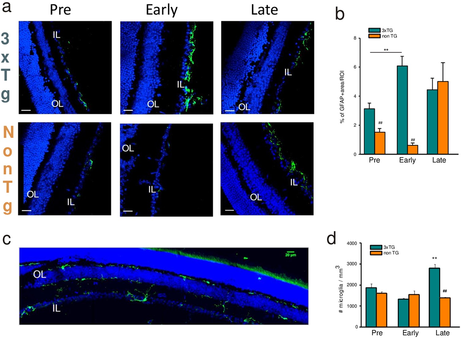 Fig. 2: Glial cells density is differently modulated during AD progression.