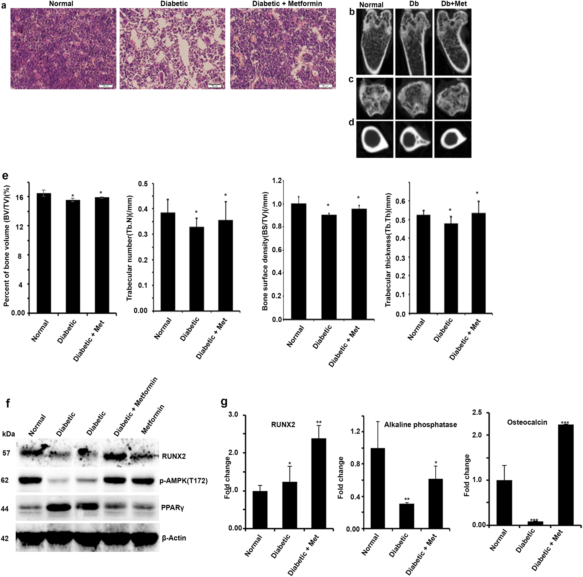 Fig. 5: Streptozotocin-induced diabetic bone adipogenesis is abrogated by pharmacological activation of AMPK by metformin.