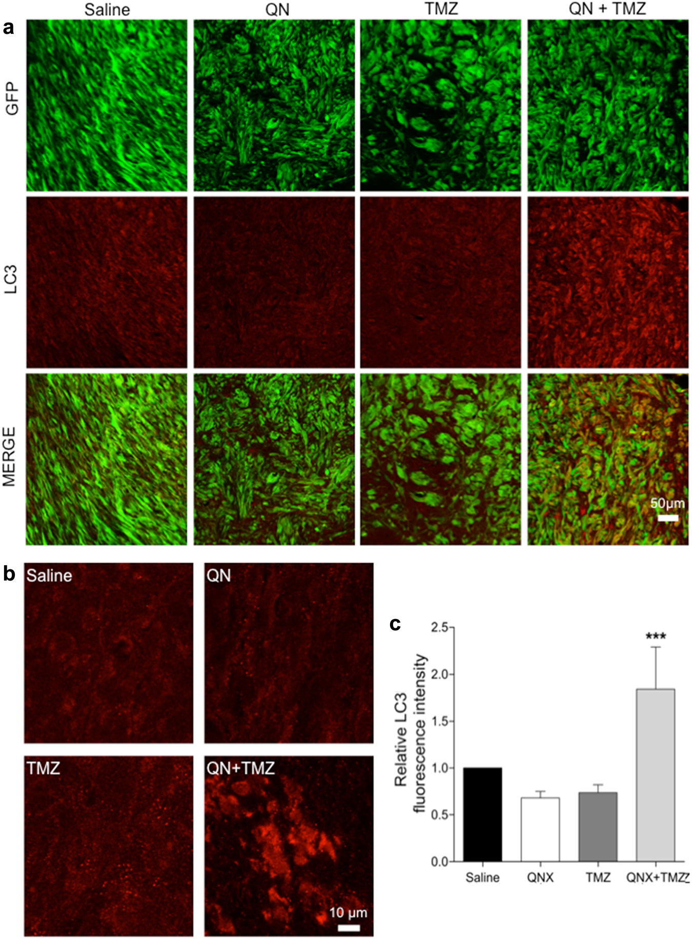 Fig. 9: Anti-LC3 immunostaining for assessment of autophagy in GSC#1 brain xenografts treated with QN, TMZ, and combined TMZ plus QN.