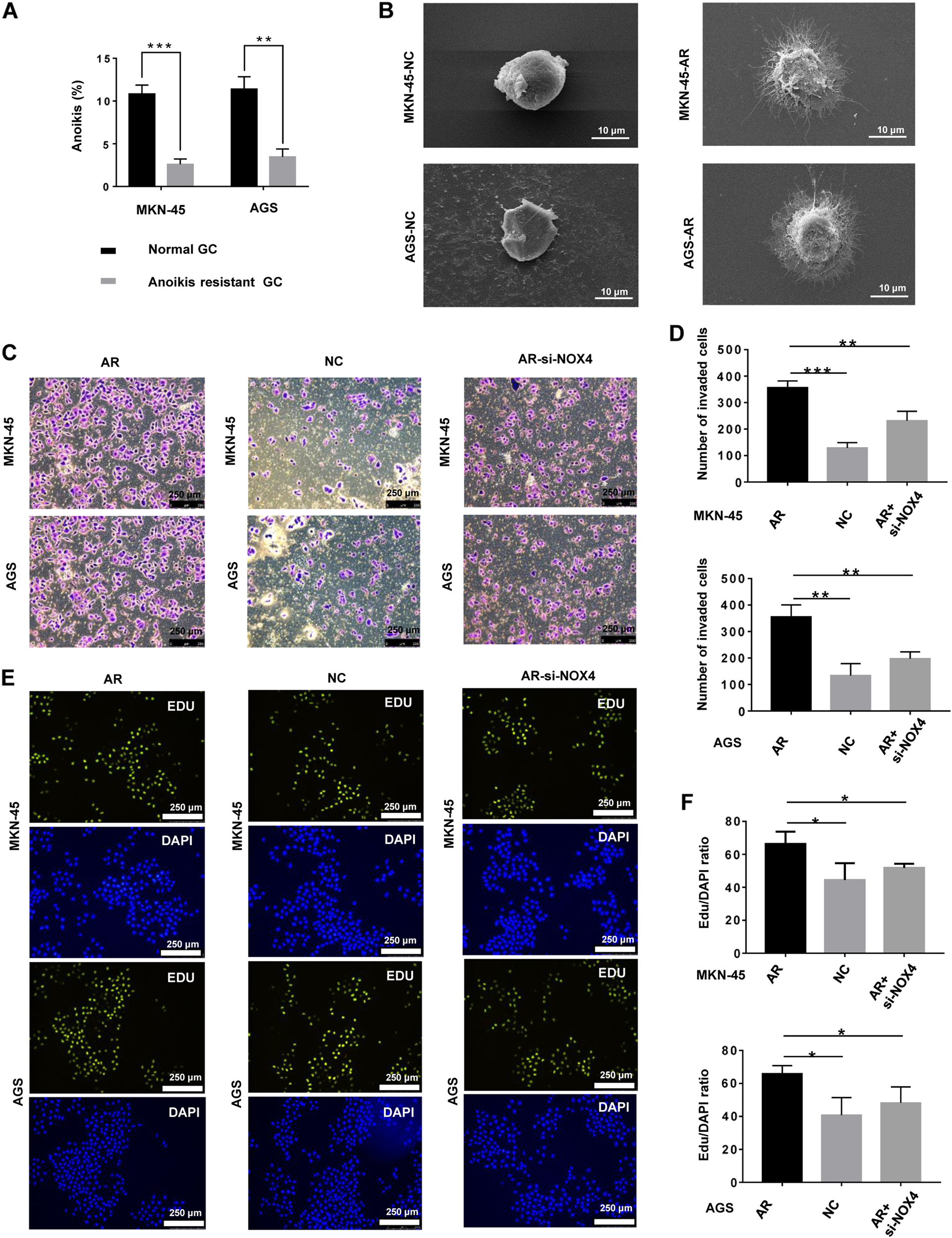 Fig. 6: The biological characteristics of anoikis-resistant gastric cancer cells.